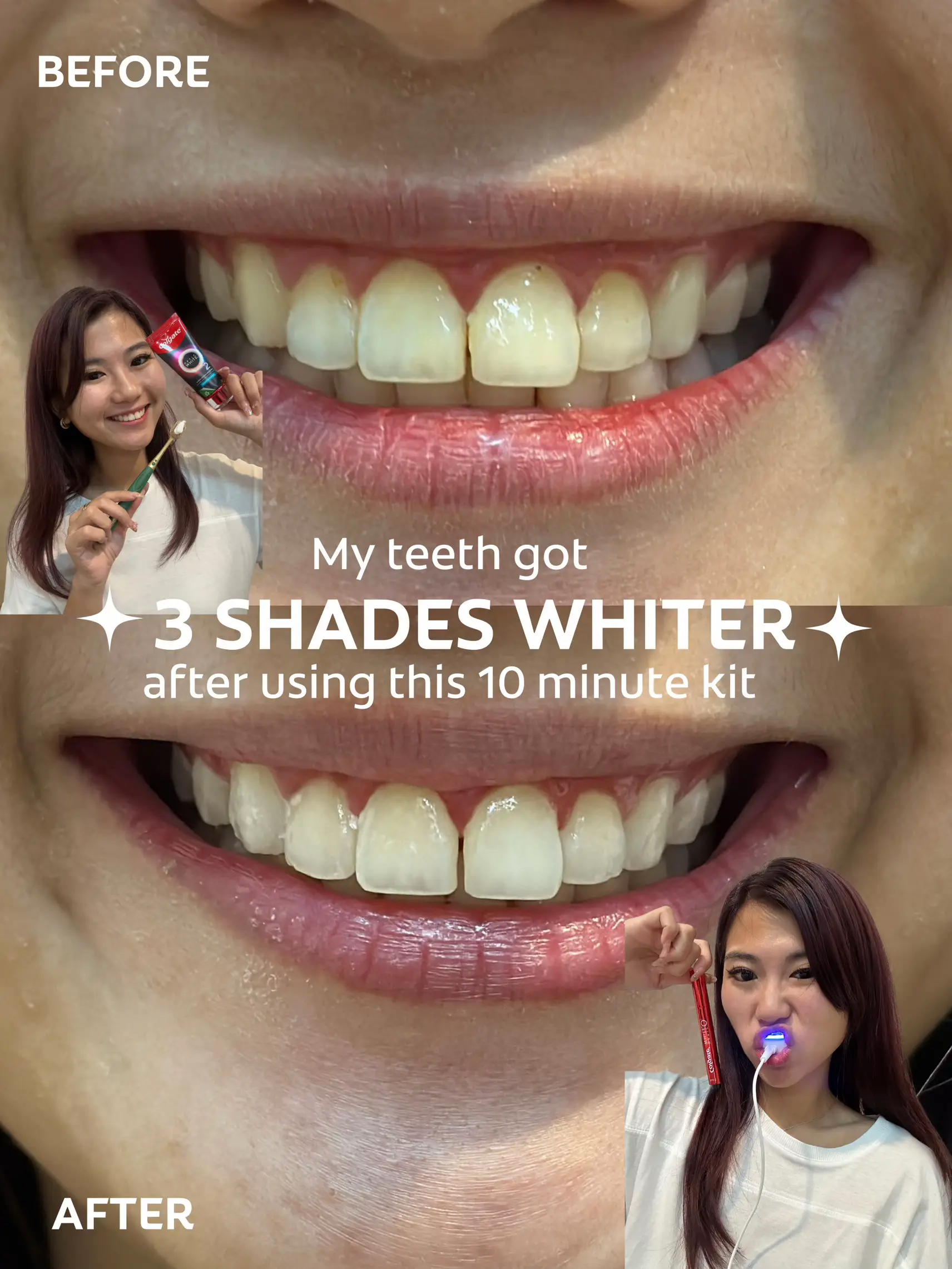 how to get White teeth - Lemon8 Search