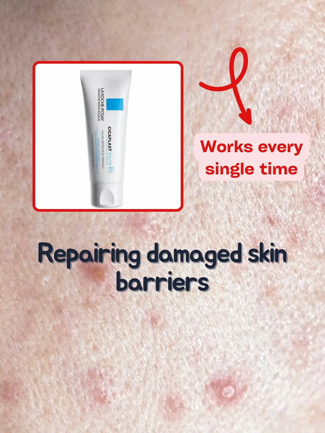 The formula to repairing damaged skin barriers 🤫 | Video published by ...