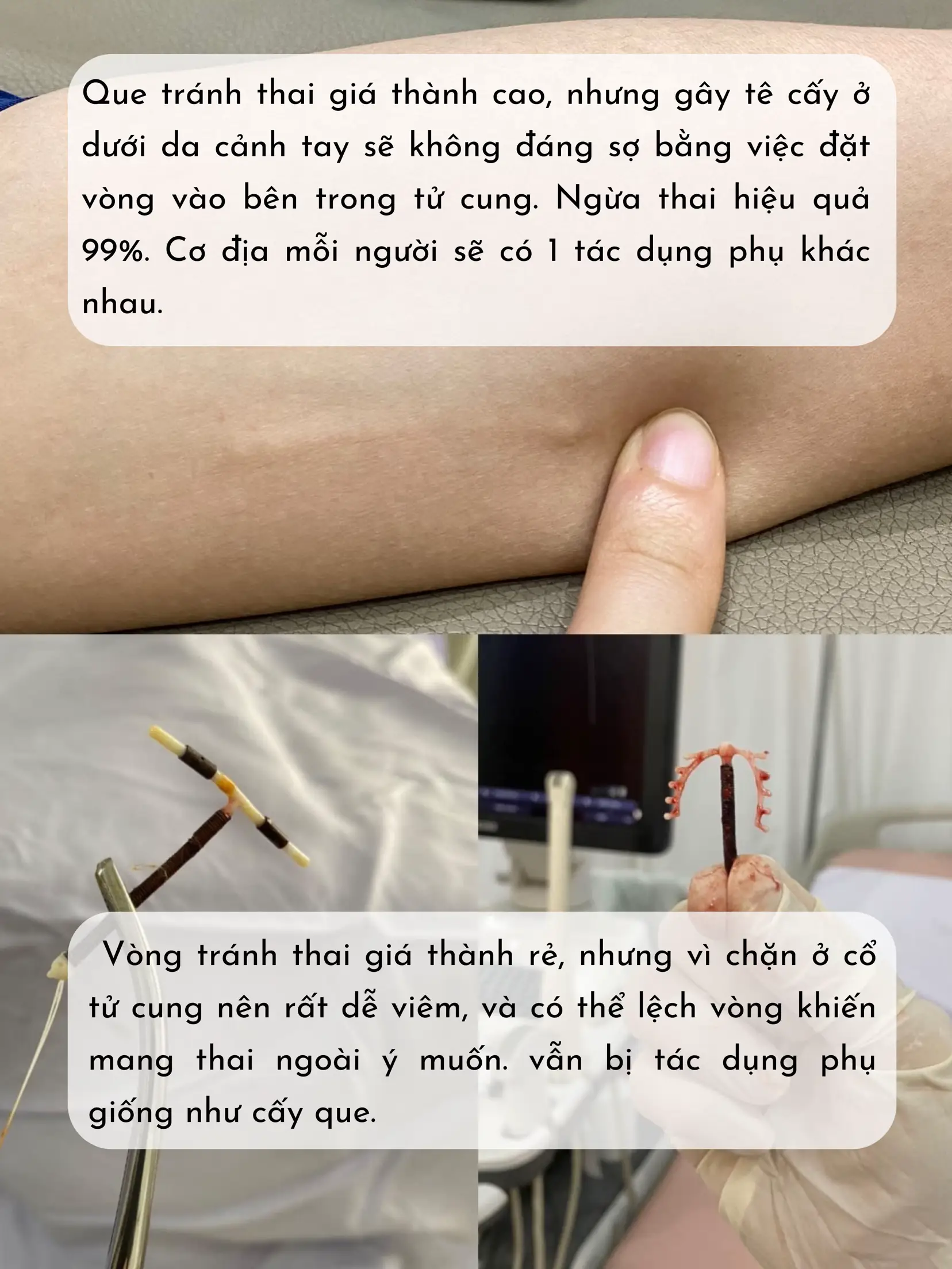 7. Đối Tượng Không Nên Sử Dụng Đặt Vòng hoặc Cấy Que