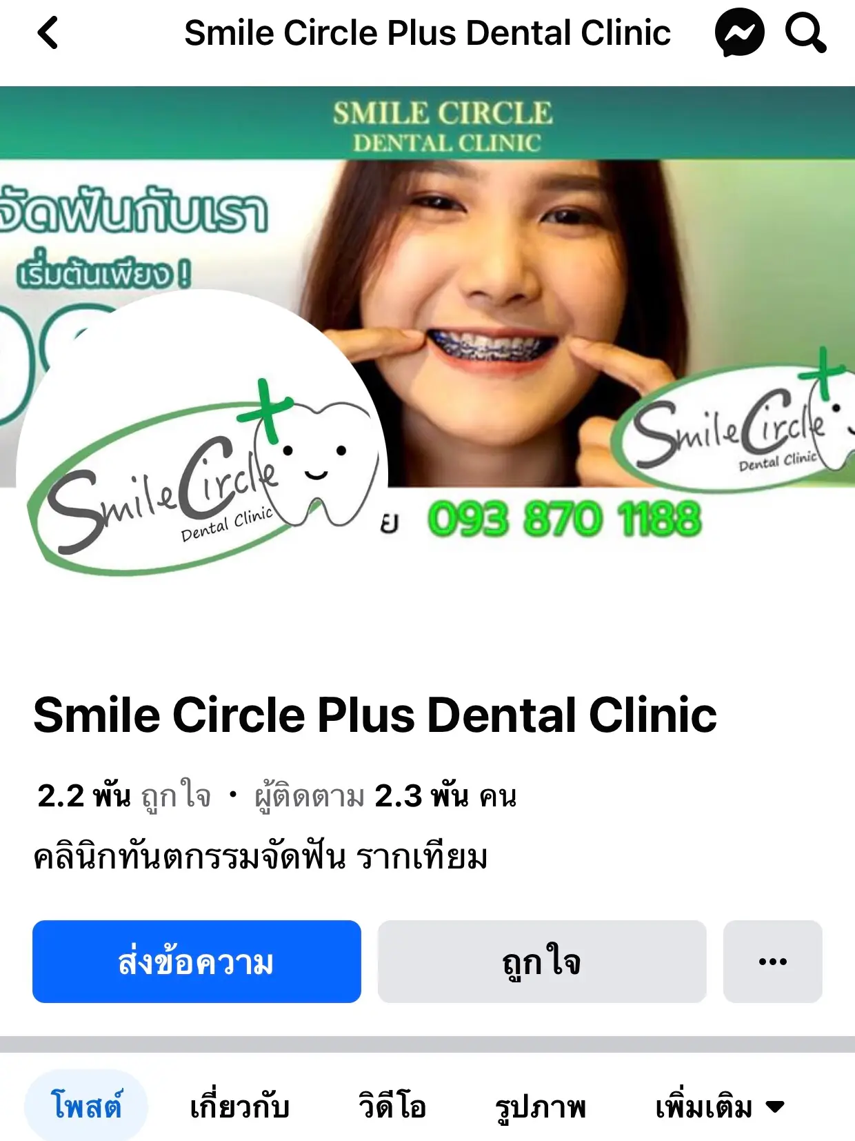 ทำรีเทนเนอร์จ่ายแค่คู่ละ 1,500฿ จบจริงไม่จ้อจี้👄 แกลเลอรีที่โพสต์โดย