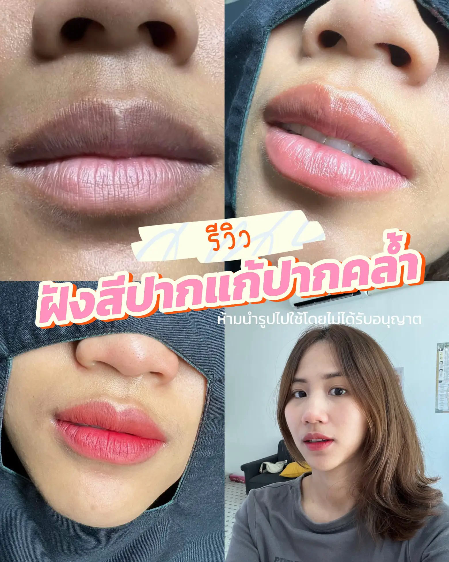 ฝังสีปากแก้ปากคล้ำ หน้าสดก็รอด รู้งี้ทำนานละ 😂 | แกลเลอรีที่โพสต์โดย ...