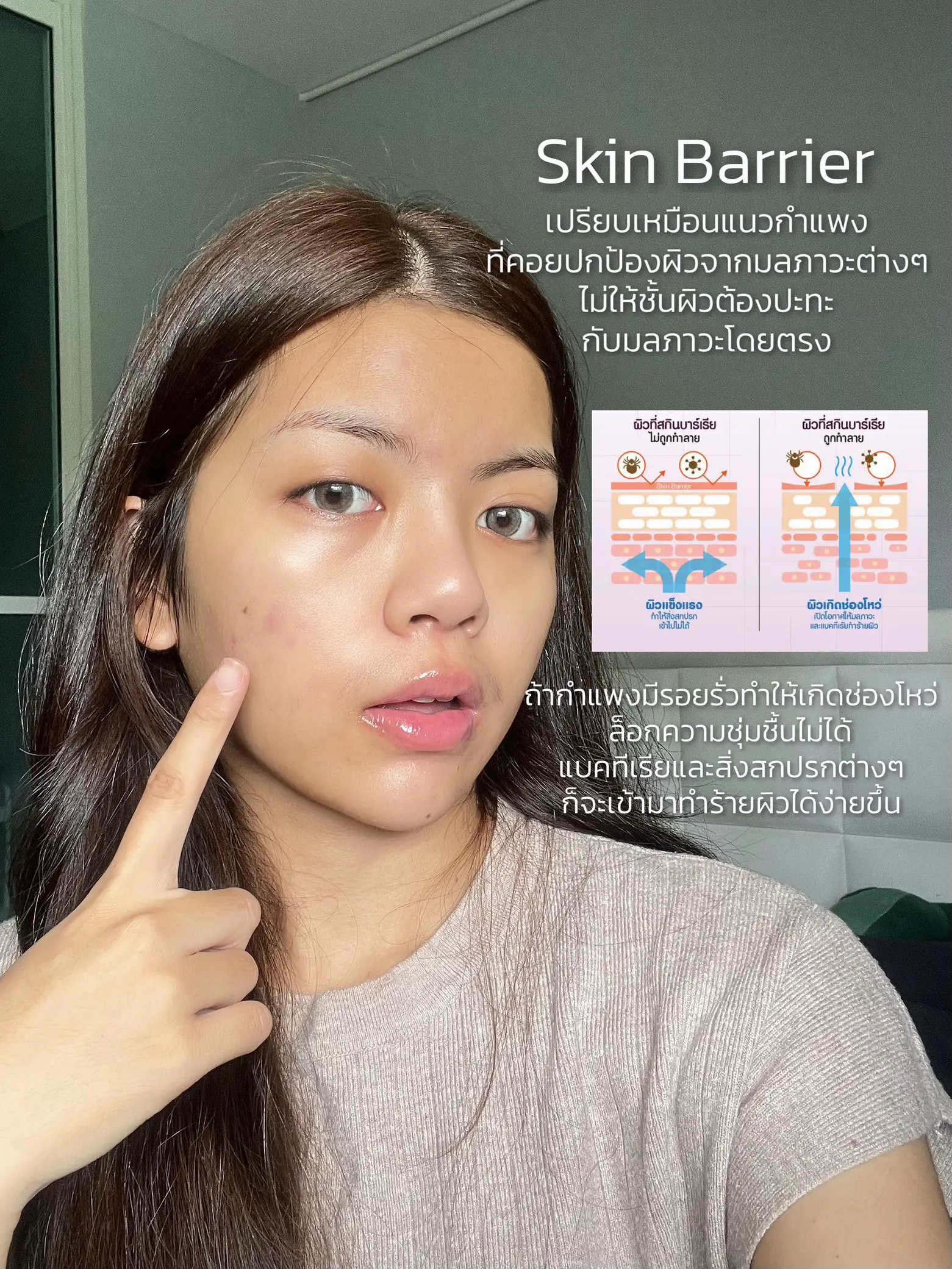 4 สัญญาณเตือน Skin Barrier พัง ⚠️ 