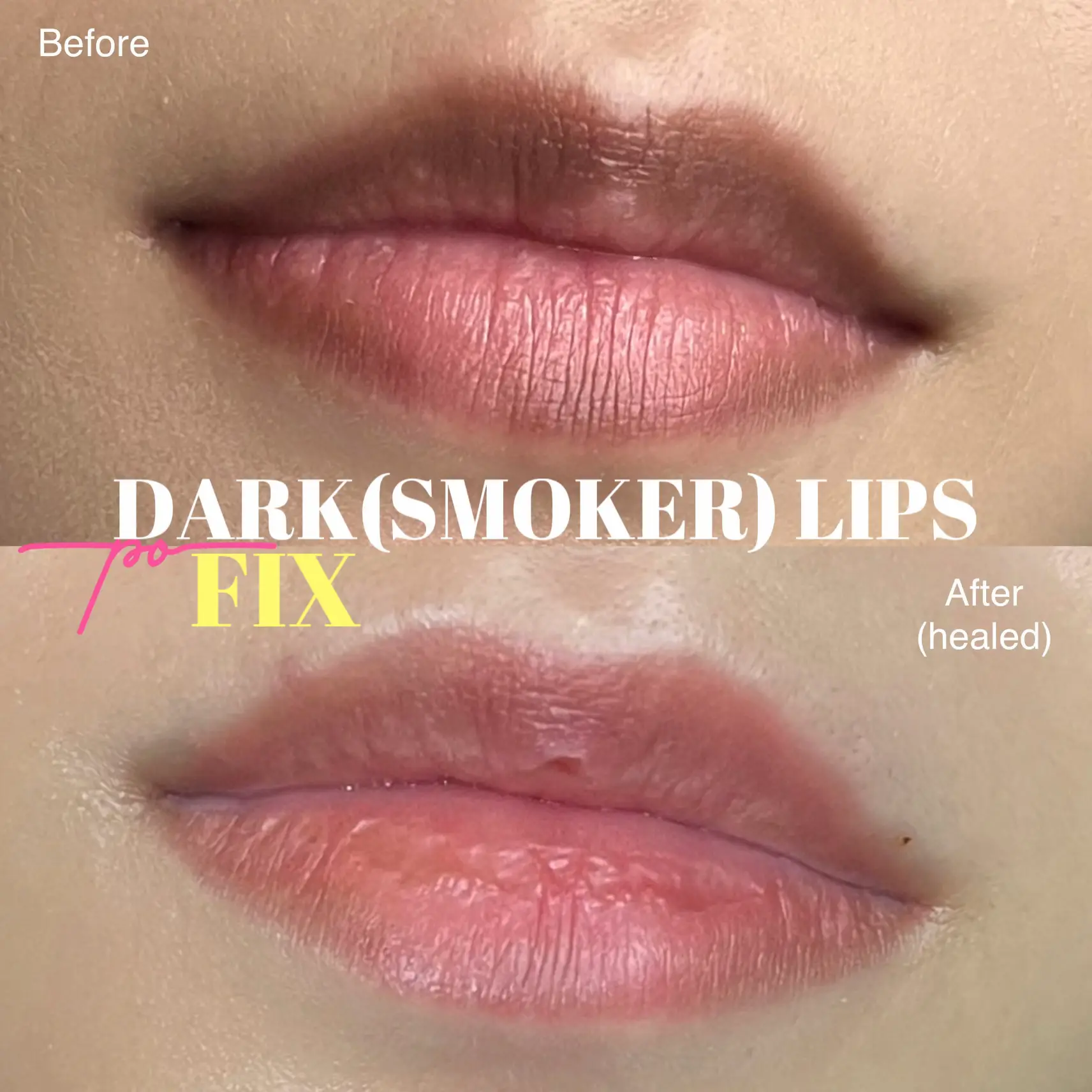 20 top Blending Your Lips ideas in 2024