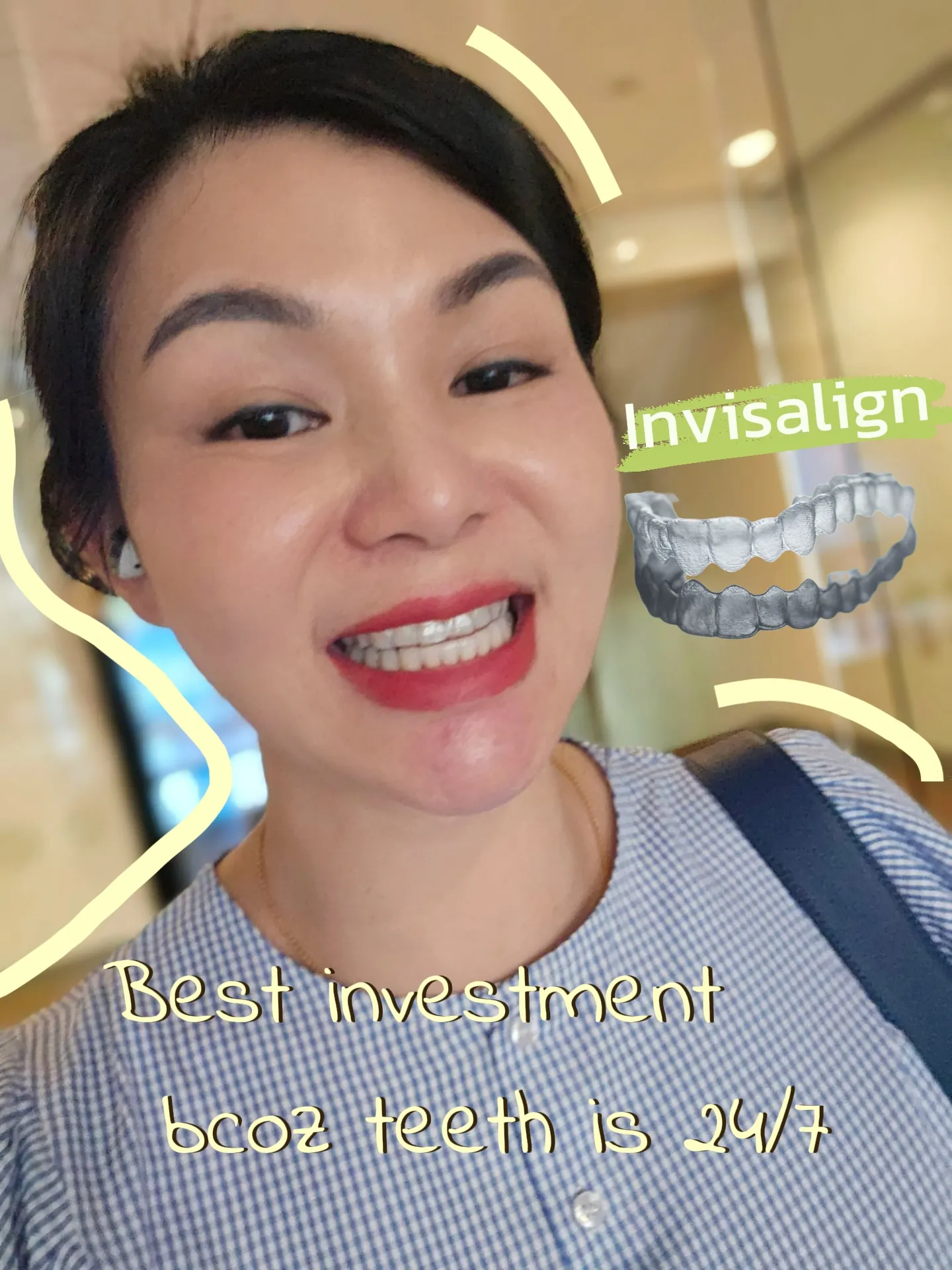 Invisalign Case - Invisalign Aligner and Retainer Case - Tooth Booth
