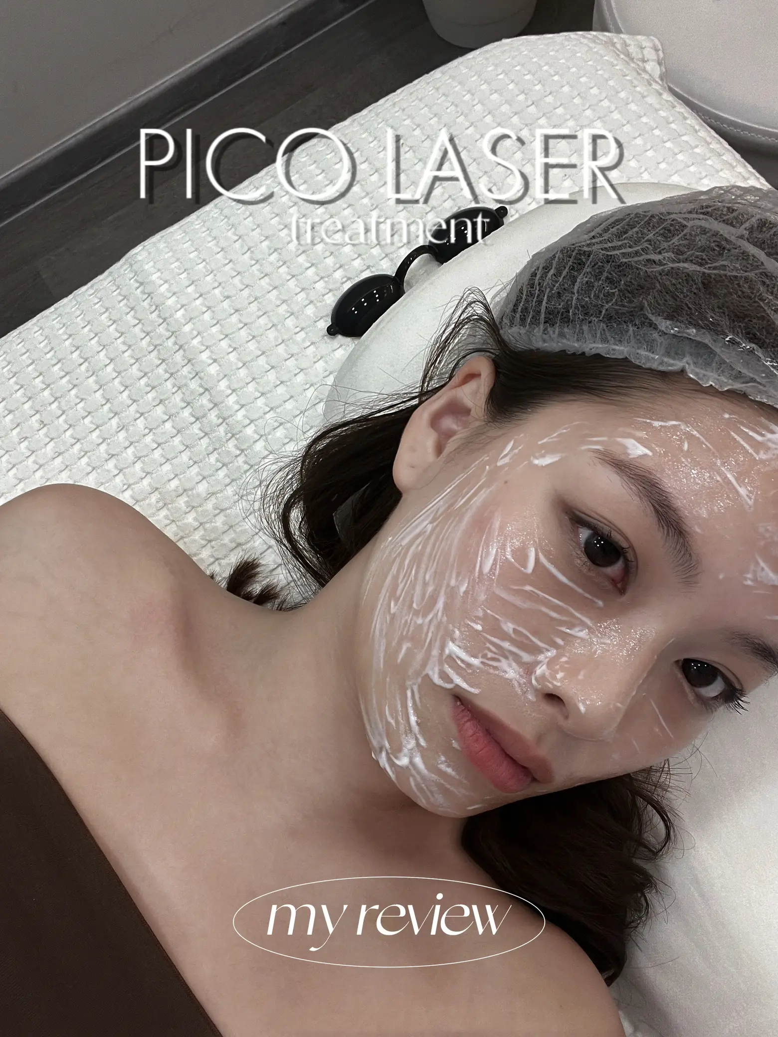 i tried pico laser for 3 months⚡️'s images(0)