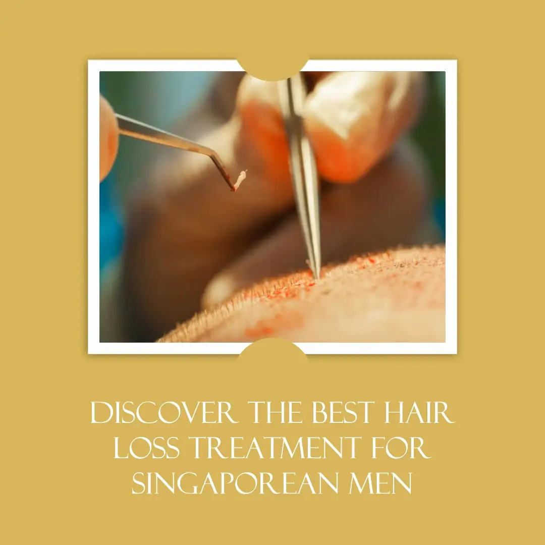 Uncover the Secret: SG Men & Hair Loss's images