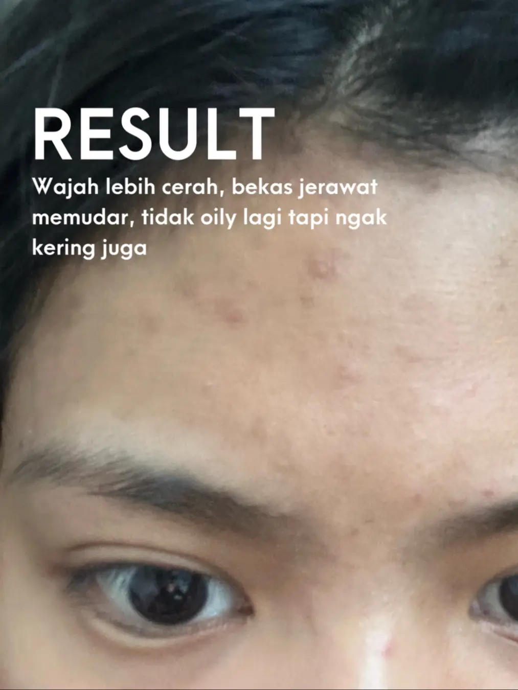 Scrub ter gentle untuk wajah berjerawat? | Galeri diposting oleh ...