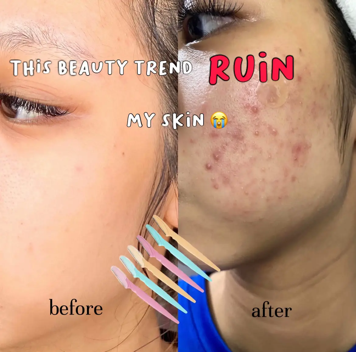 THIS BEAUTY TREND RUINED MY SKIN 😭's images(0)