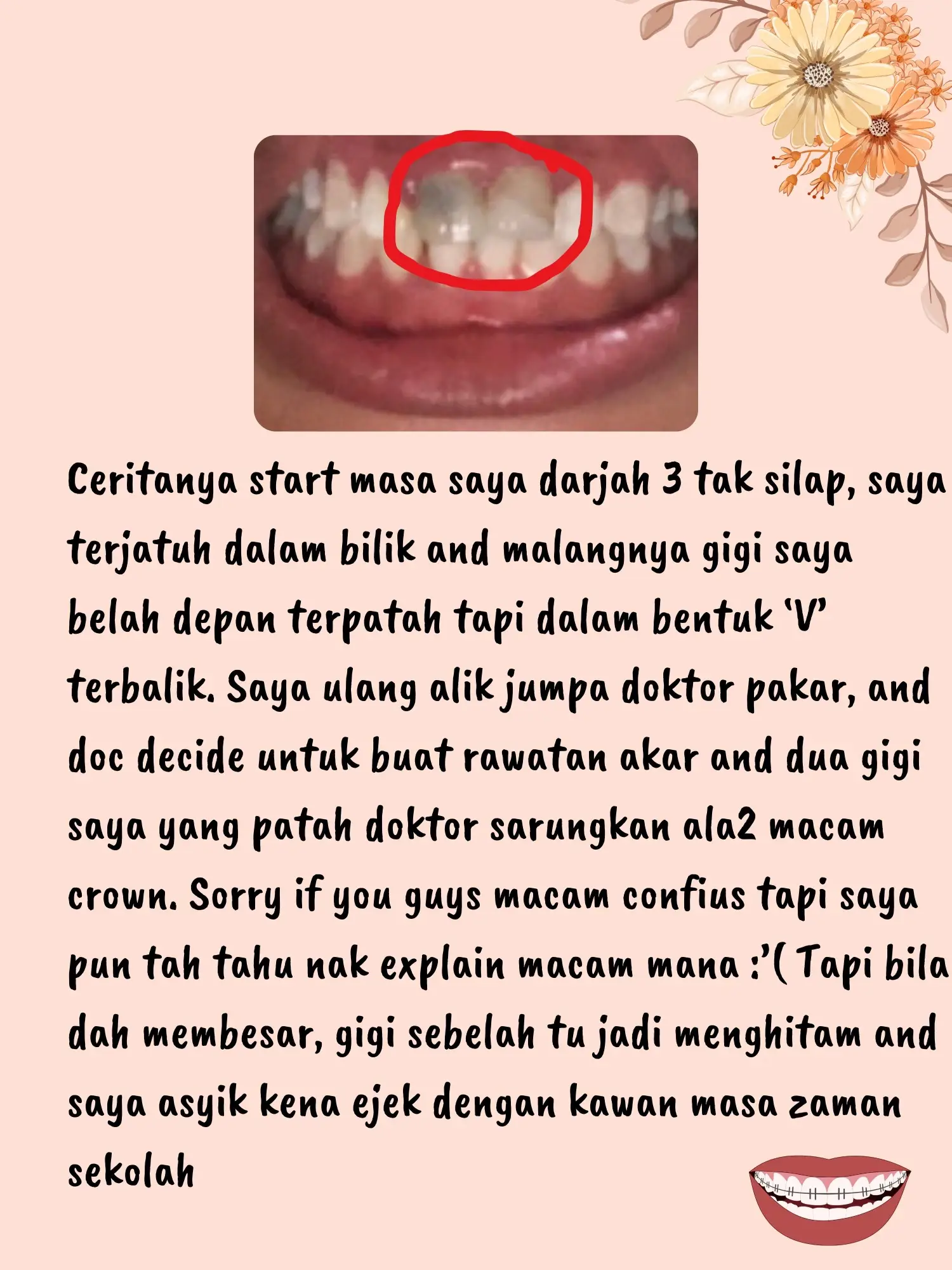 Kenapa Saya Pilih Braces | Gallery posted by Sya journey | Lemon8