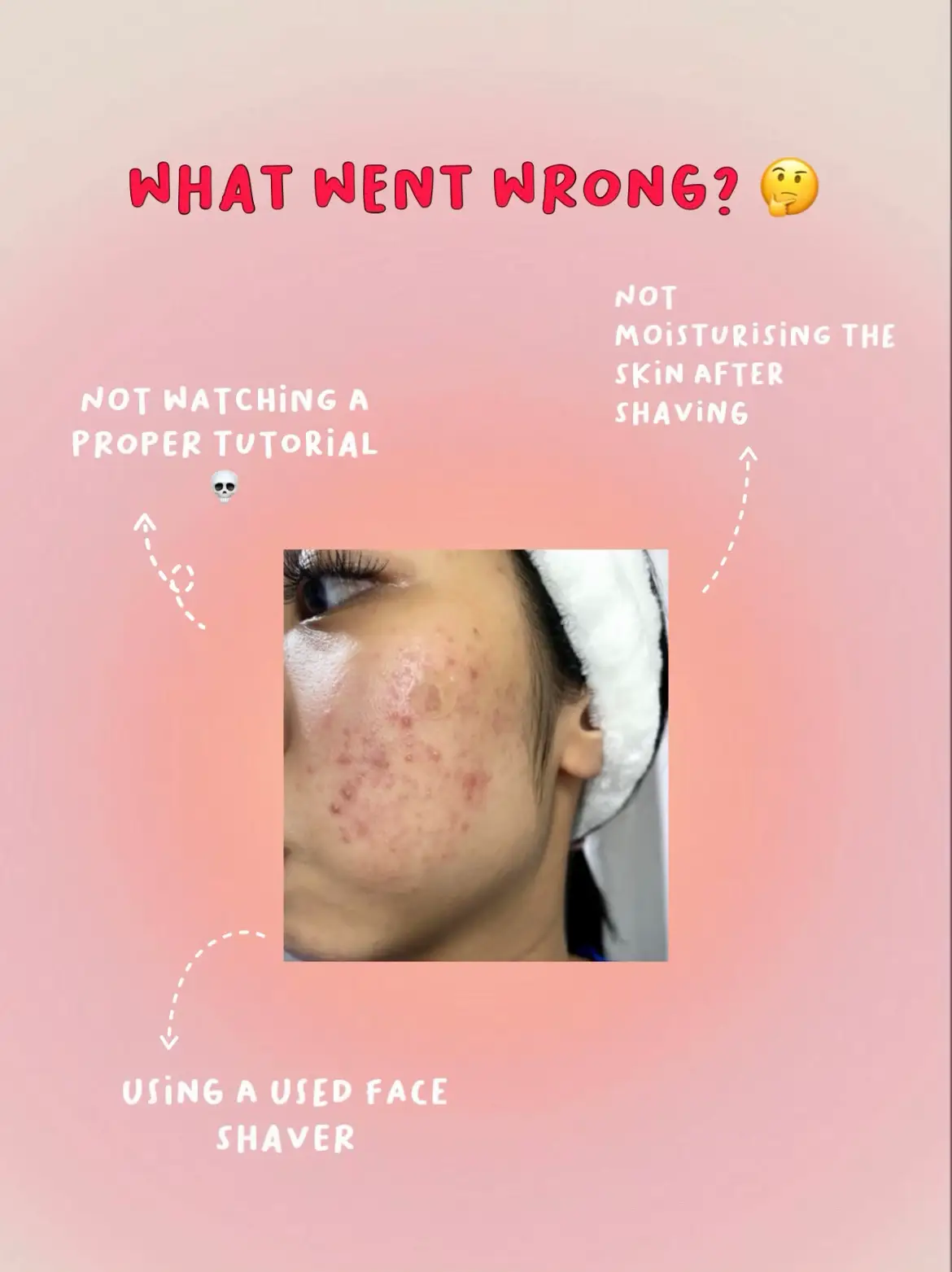 THIS BEAUTY TREND RUINED MY SKIN 😭's images(4)