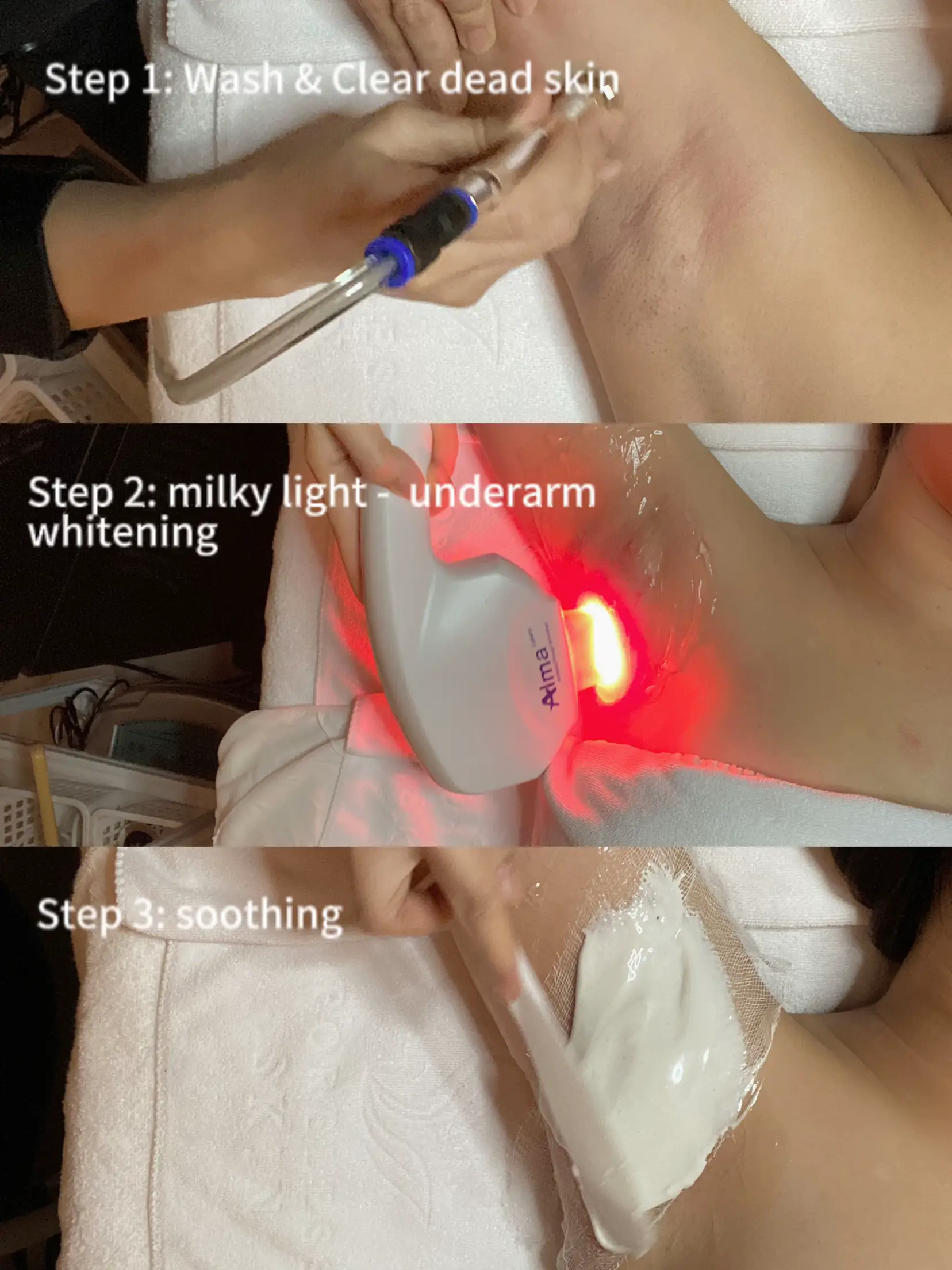 Brightening Underarms/Booty Crack Combo (even your skin tone