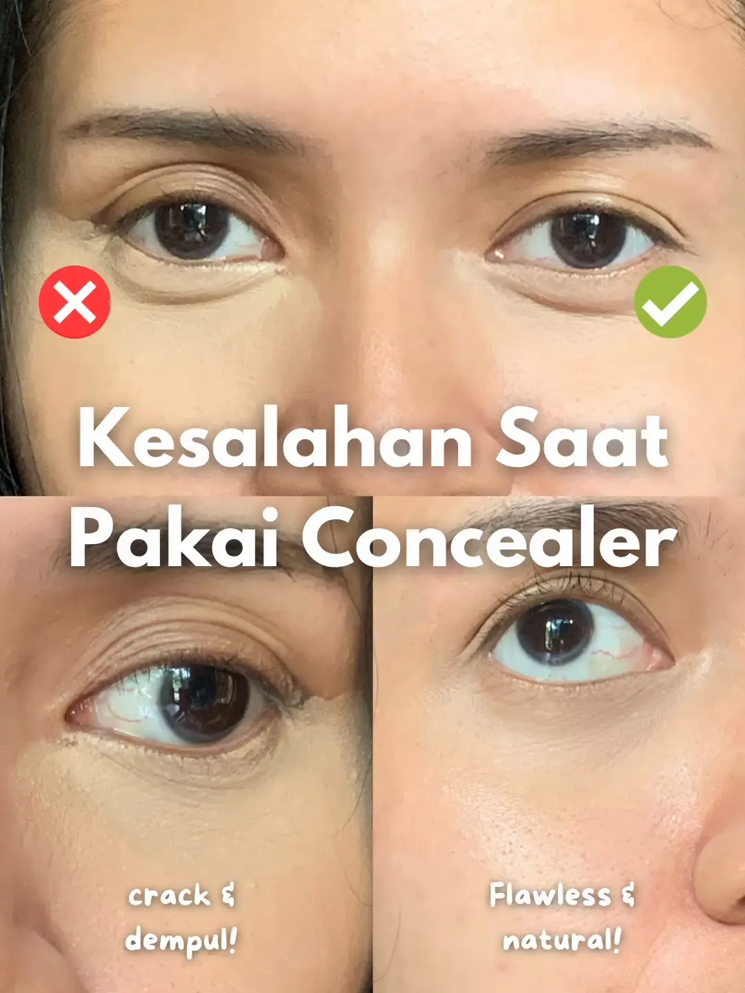 Kesalahan Saat Pakai Concealer | Video Dipublikasikan Oleh Salmahadids ...