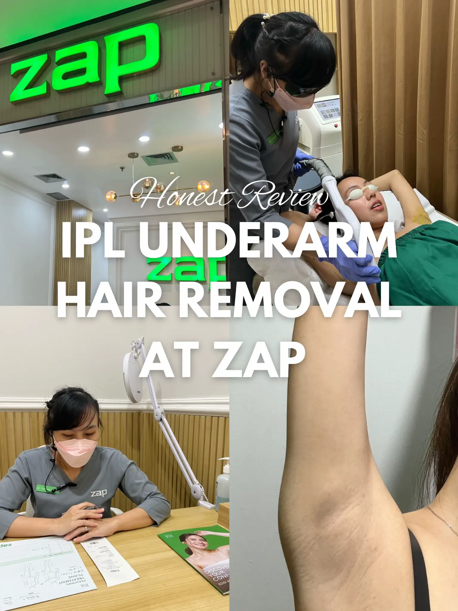 STOP WAXING IPL UNDERARM ZAP MUST TRY Gallery posted by