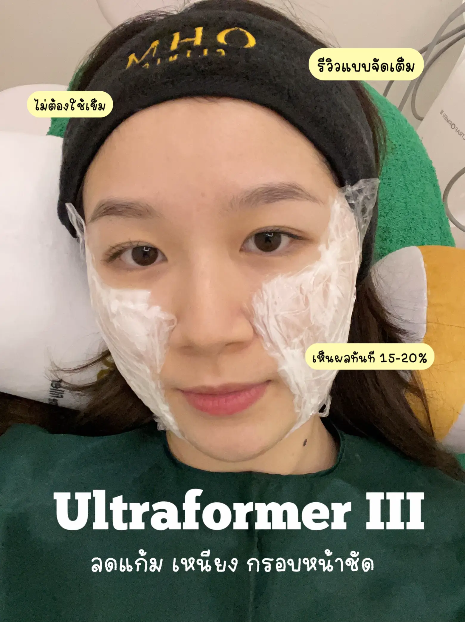 รีวิว Ultraformer Iii ลดแก้ม เหนียง กรอบหน้าชัดทันที💖🧚🏻‍♀️ แกลเลอรีที่โพสต์โดย Ernyanass Lemon8 9458