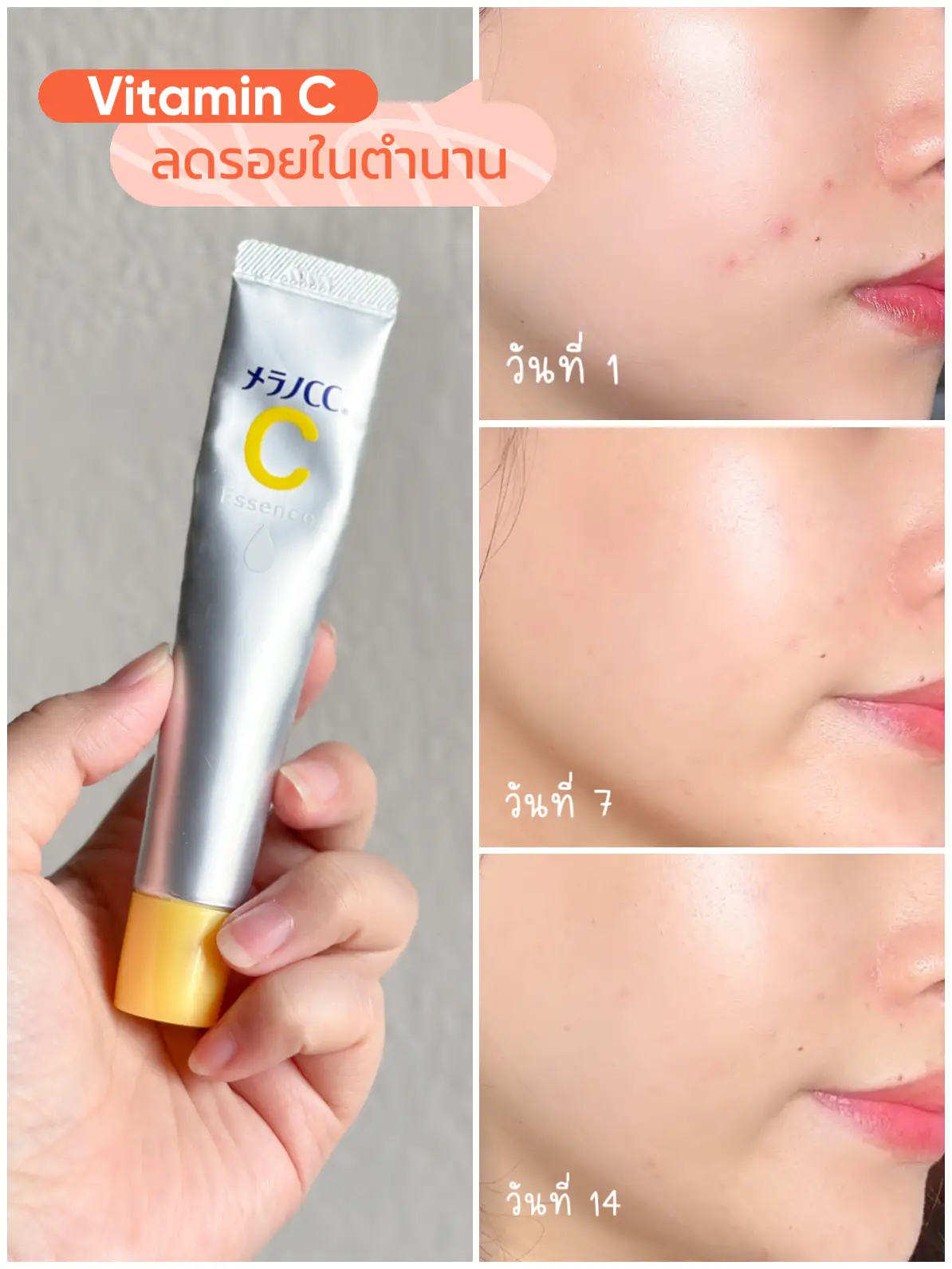 วิตามินซีเซรั่ม ญี่ปุ่น - การค้นหาใน Lemon8