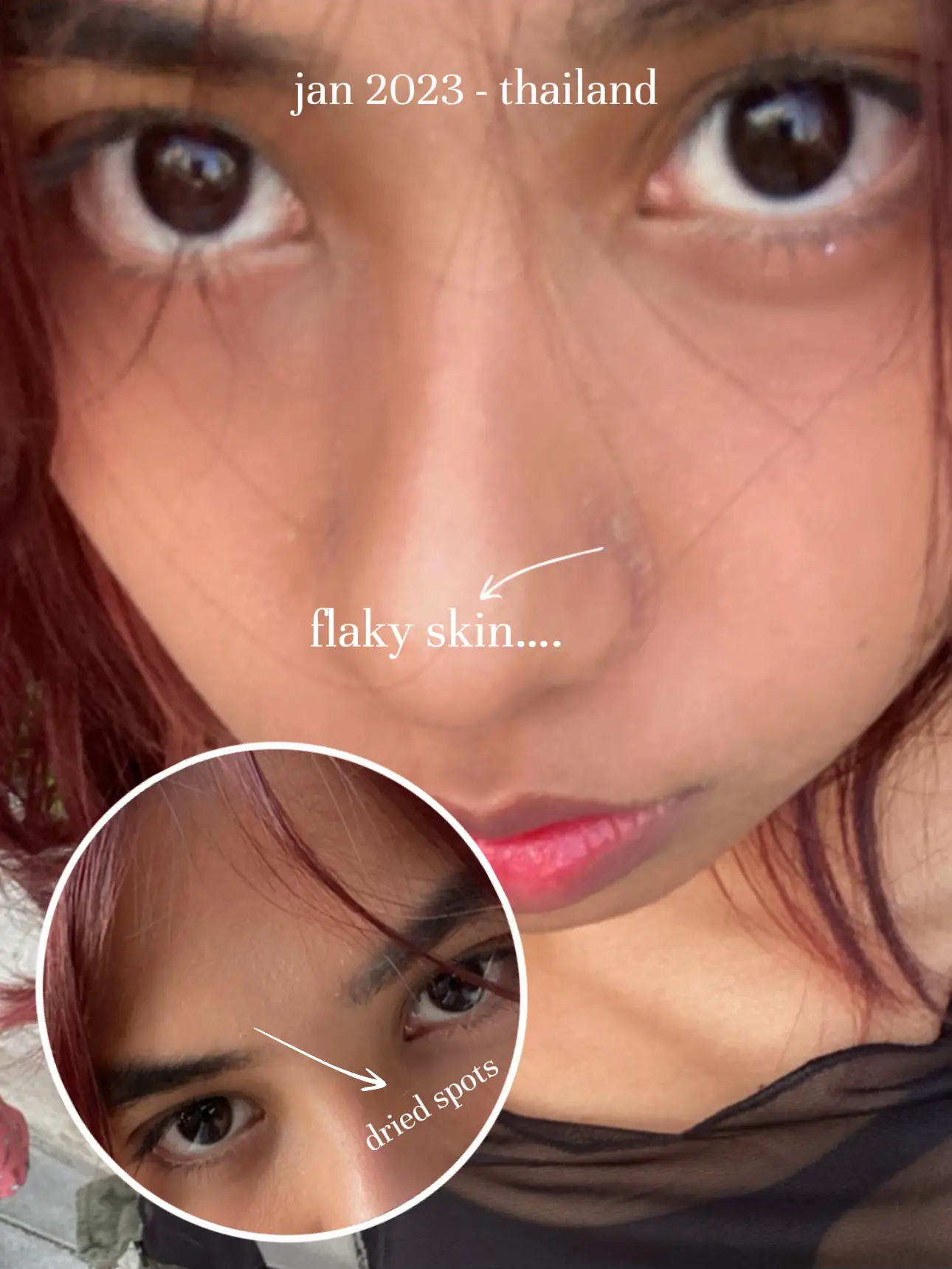 skincare RUINED my skin's images(1)