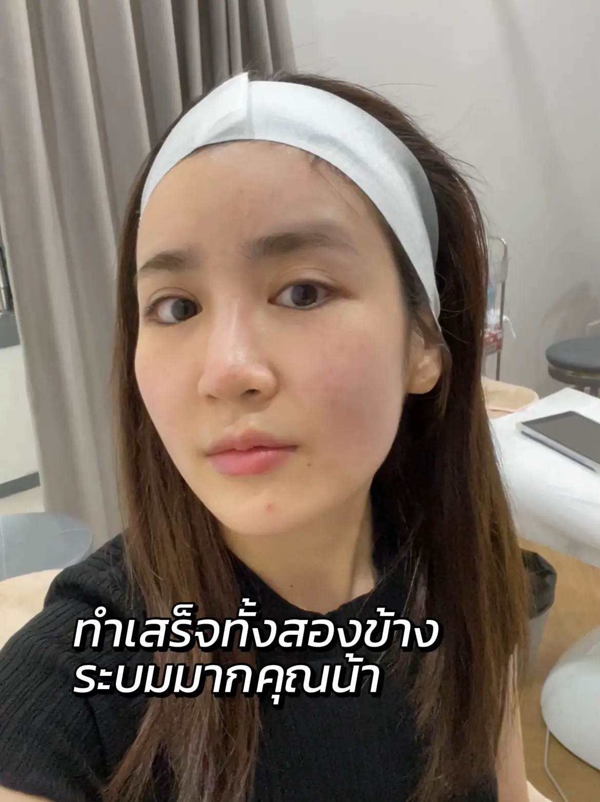 รีวิวทำ Hifu 7D @tamada clinic bts ปุณณวิถี ☁️ | แกลเลอรีที่โพสต์โดย ...