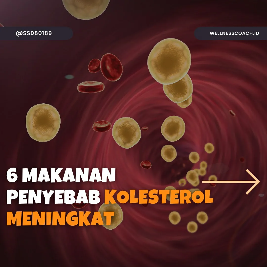 6 Makanan Penyebab Kolestrol Meningkat Galeri Diposting Oleh