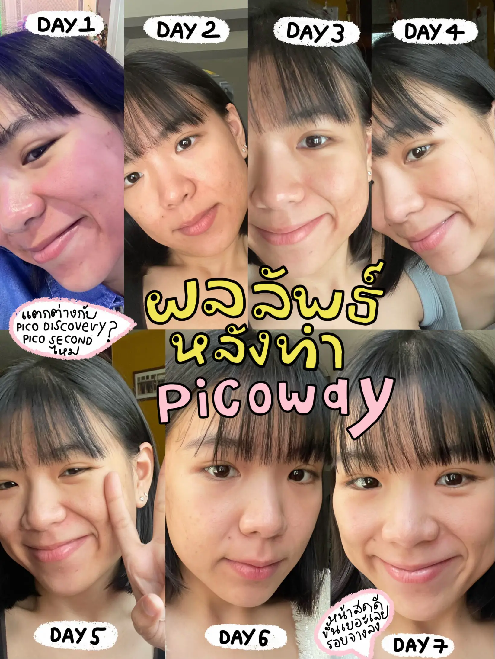 “ผลลัพธ์ Pico Way” ต่างจาก Pico ชนิดอื่น ?‼️💥 