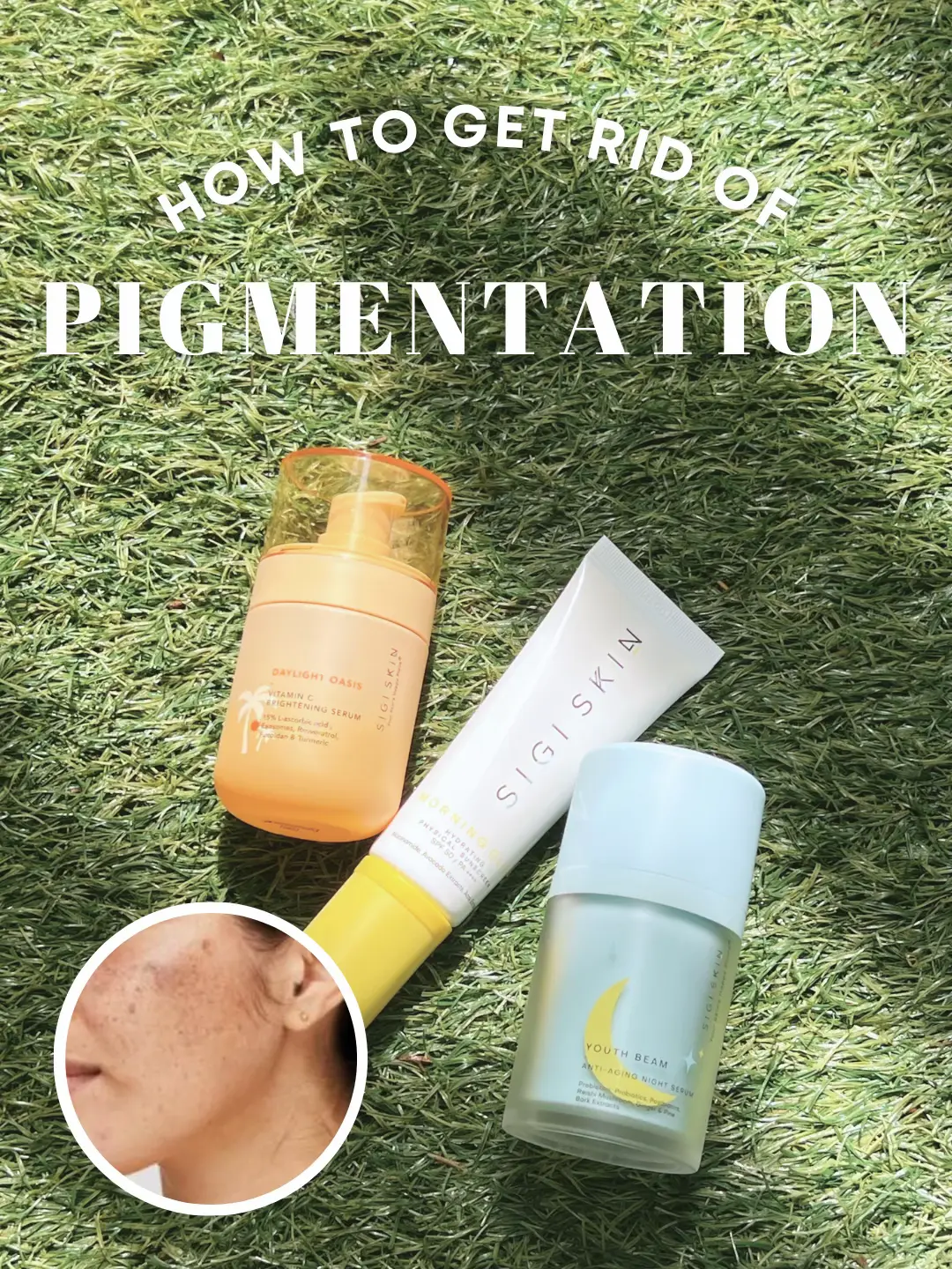 ✨ How To Get Rid Of Hyperpigmentation ✨'s images(0)