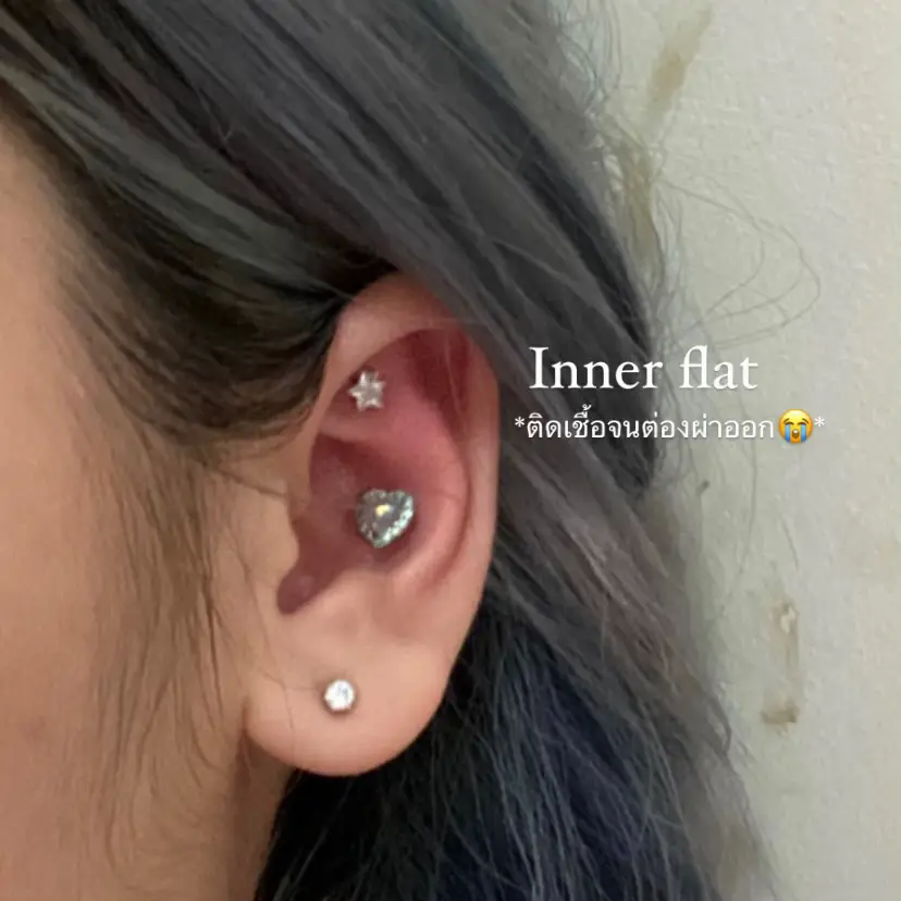 Ear piercing review (almost all positions) Gallery posted by brainnyy