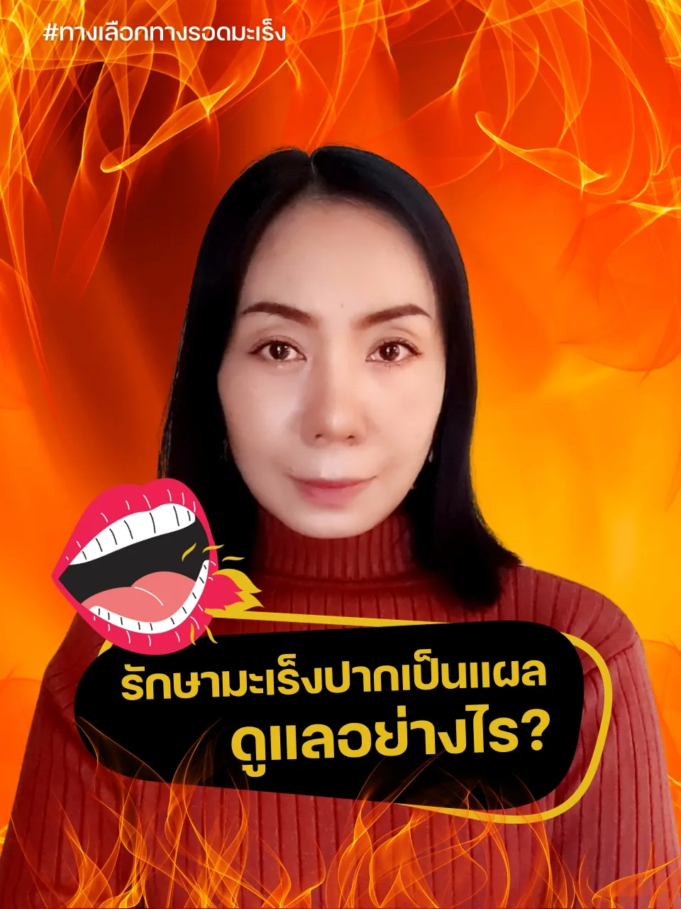 รักษามะเร็งปากเป็นแผล ดูแลอย่างไร? | แกลเลอรีที่โพสต์โดย ทางเลือกมะเร็ง ...