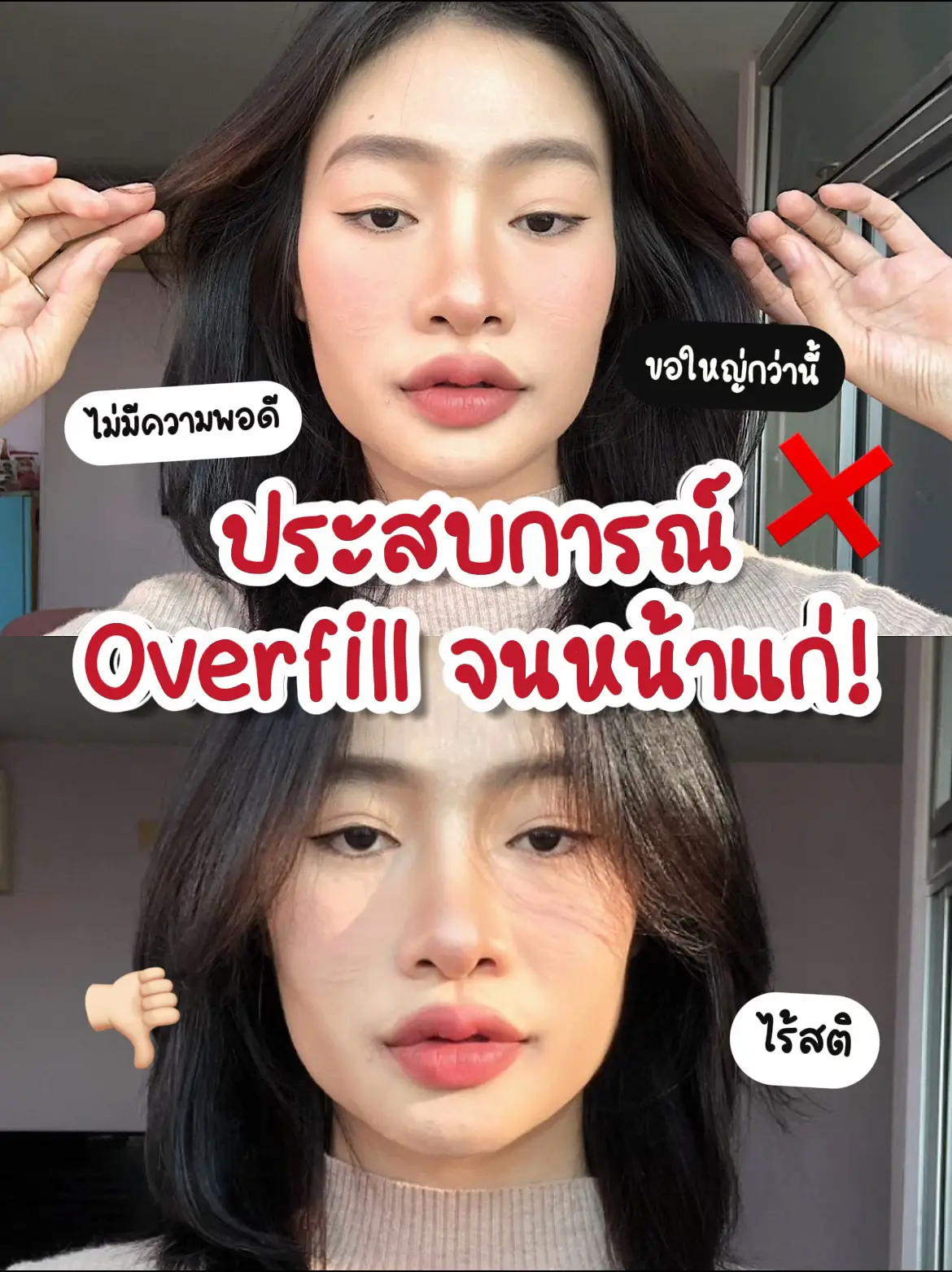 รู้ตัวตอนไหนว่าตัวเองOverfillแล้ว😭?? | แกลเลอรีที่โพสต์โดย Naoko ♡ | Lemon8