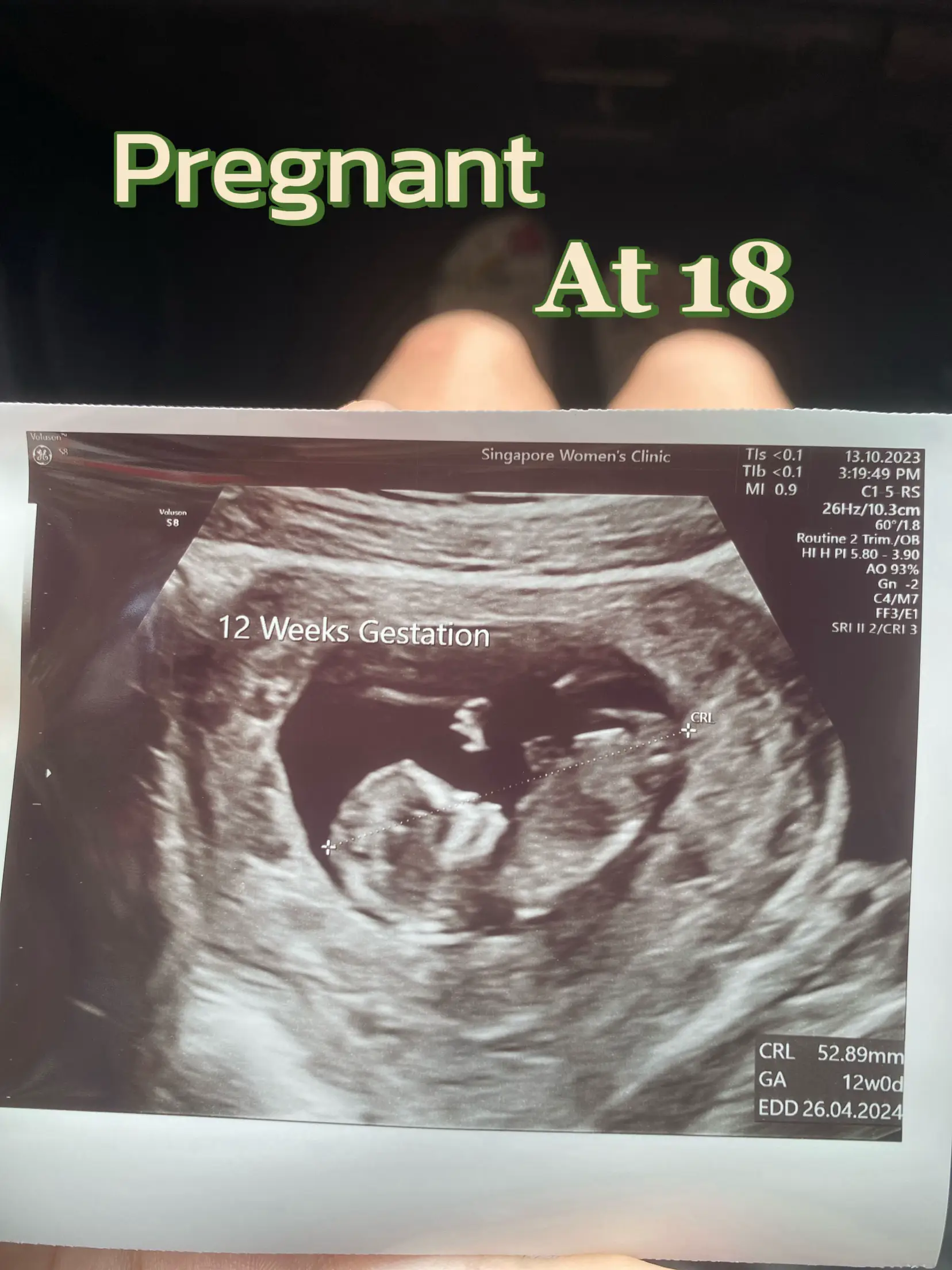 Pregnant at 18?!?'s images(0)