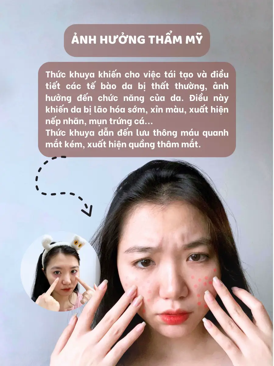 Thức khuya có hại cho da không?