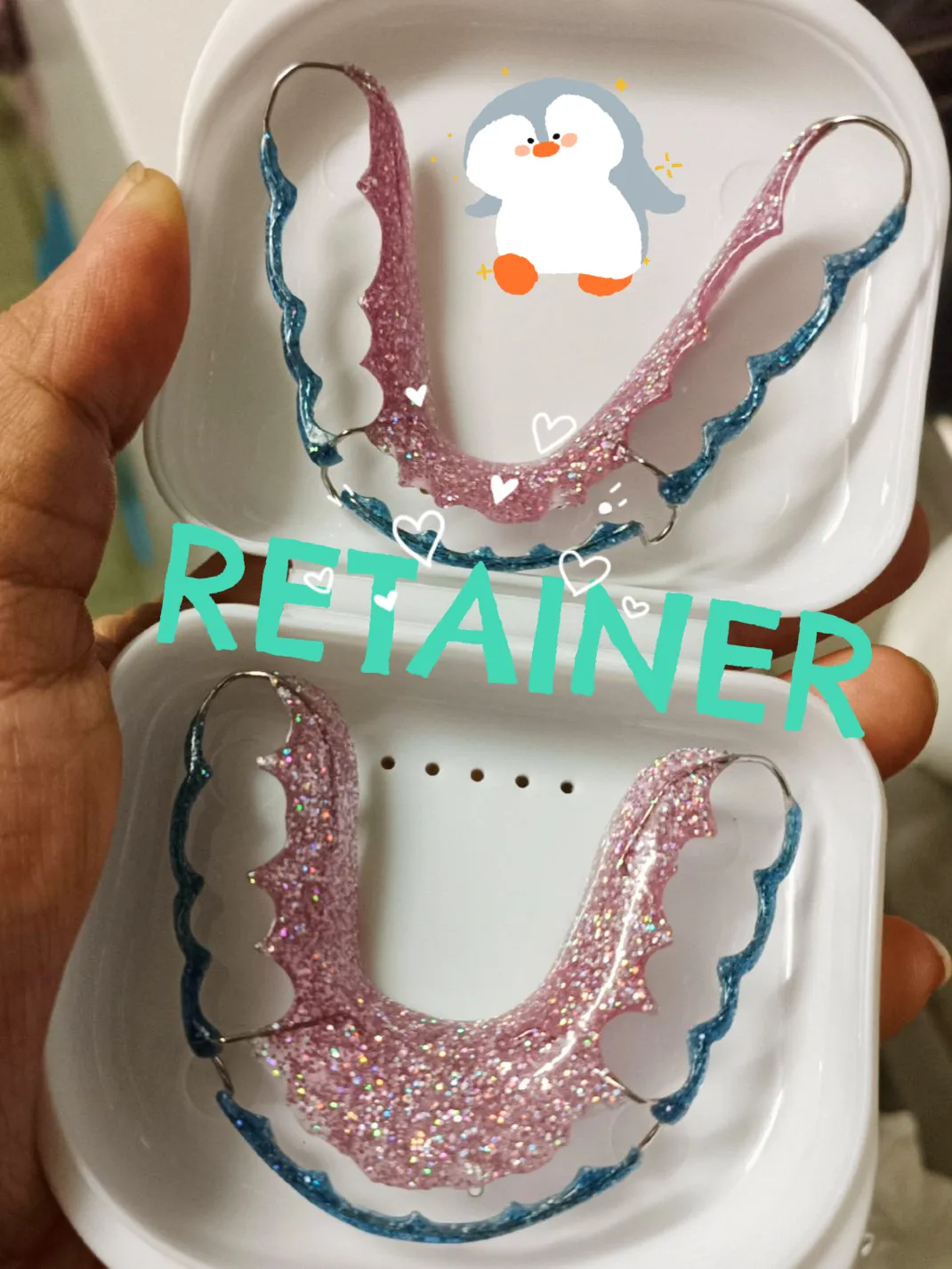 new retainer 😊 | Gallery posted by Ashiraya A-shi | Lemon8