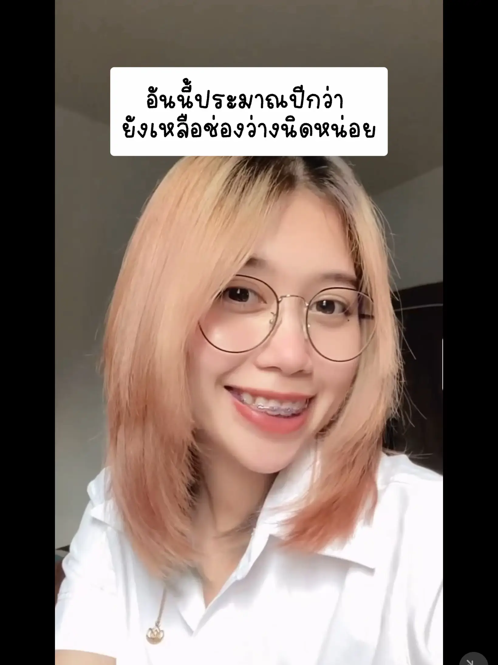 รีวิวพลีชีพ!! จัดฟันเปลี่ยนแบบปึ้งงง | แกลเลอรีที่โพสต์โดย 💘NAT🦄 | Lemon8
