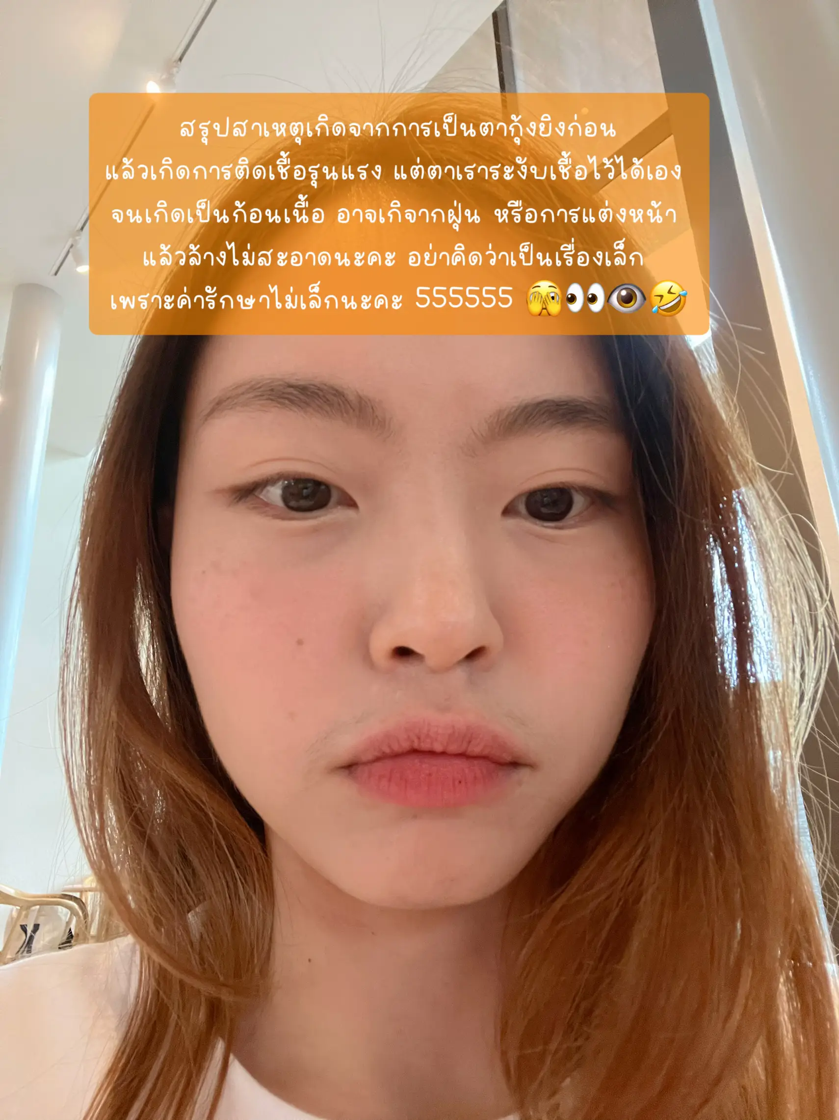 ⚠️ เตือนภัย เป็นตากุ้งยิงอย่าชะล่าใจ‼️👁🥹 แกลเลอรีที่โพสต์โดย Bunnykukkik Lemon8