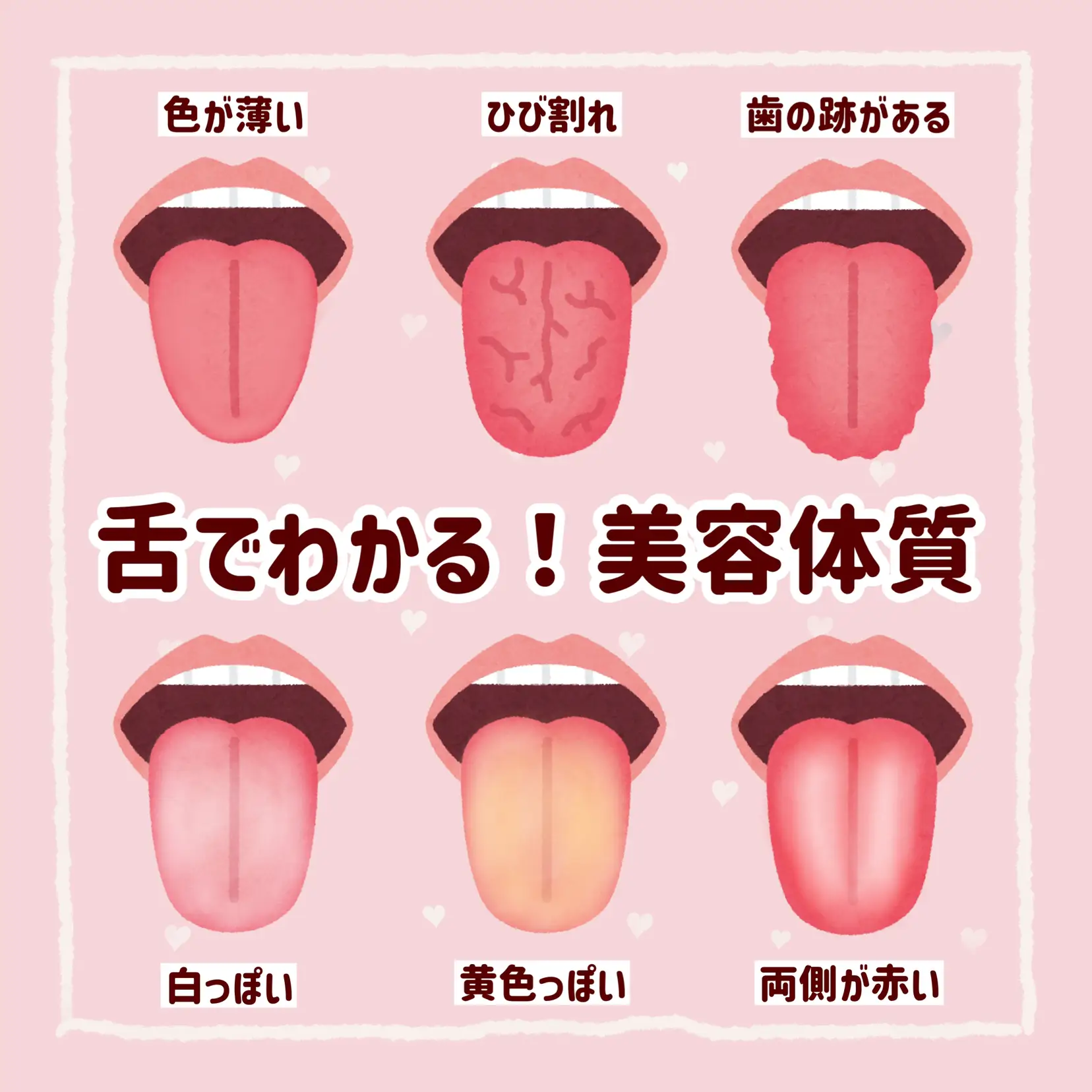 舌でわかる！あなたの美容体質💡の画像 (0枚目)