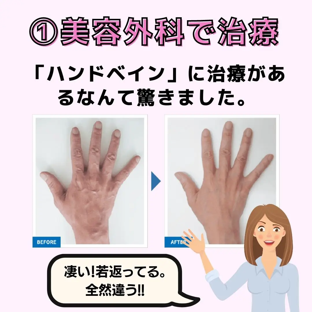 ハンドベインとは✋老け手さん必見✨ | ひとみ_アラフォー美容が投稿