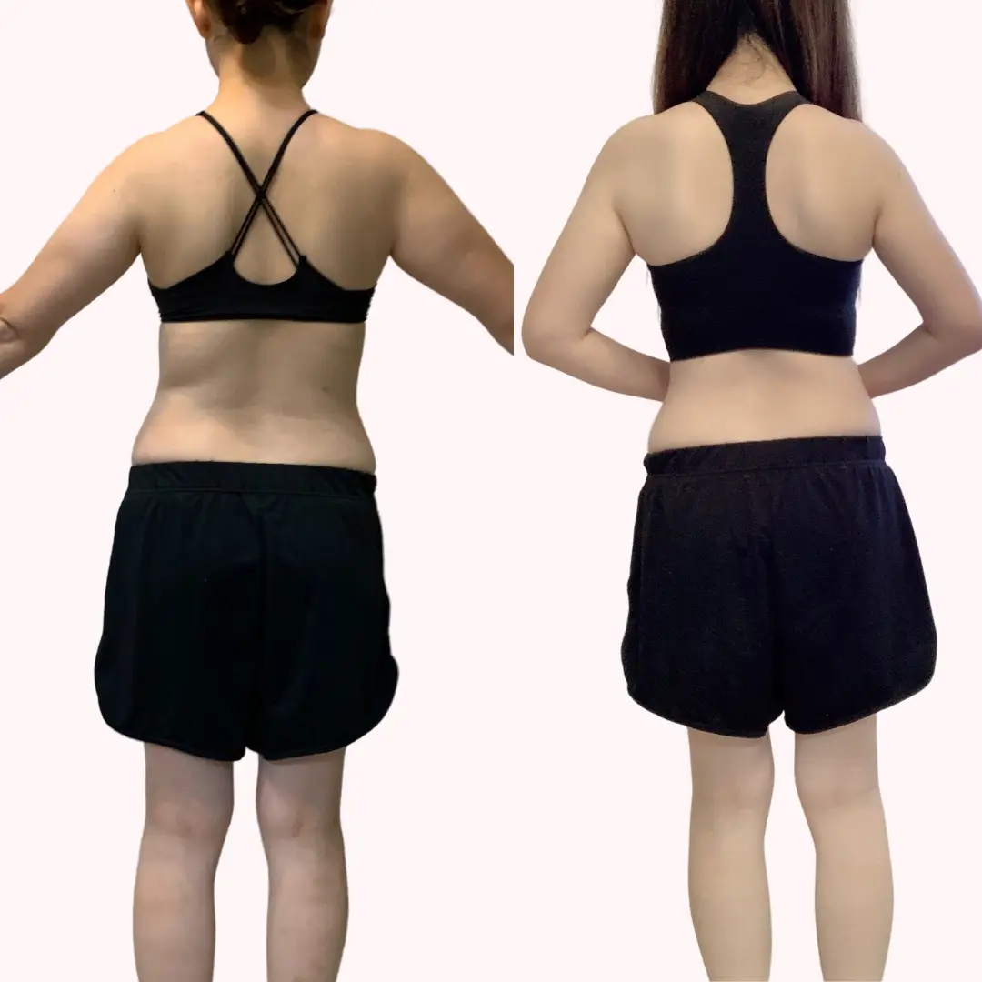 62キロ→55キロ】背中ビフォーアフター | ママダイエットあひるが投稿  