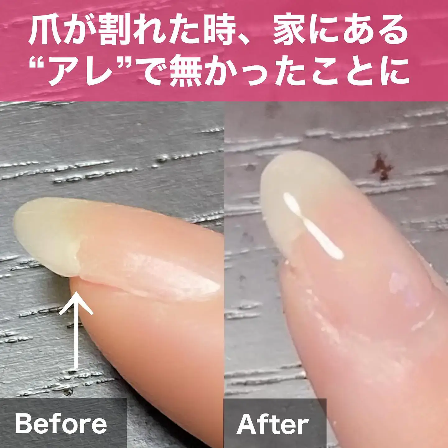 爪が割れた時の対処法】使うのは家にある〝アレ〟 | 海底のほたてが