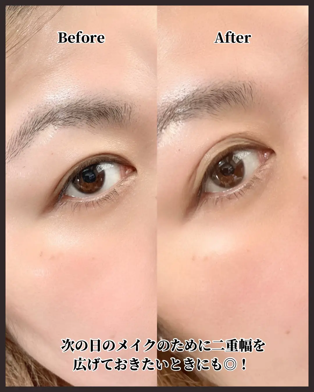 アイリーヌ二重美容液 ぎこちな