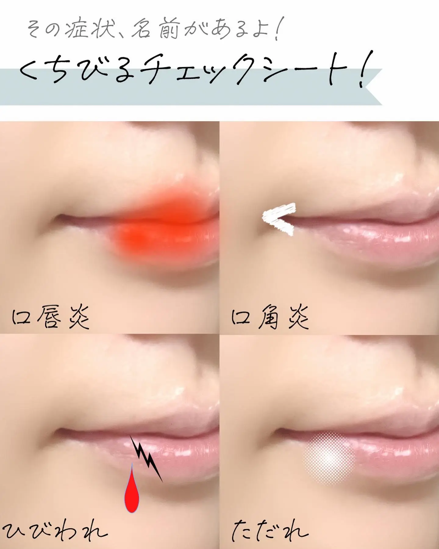 唇ぷるぷる　シルクリップフィラーサロン専売品 唇ぷるぷるシルクリップフィラーサロン専売品