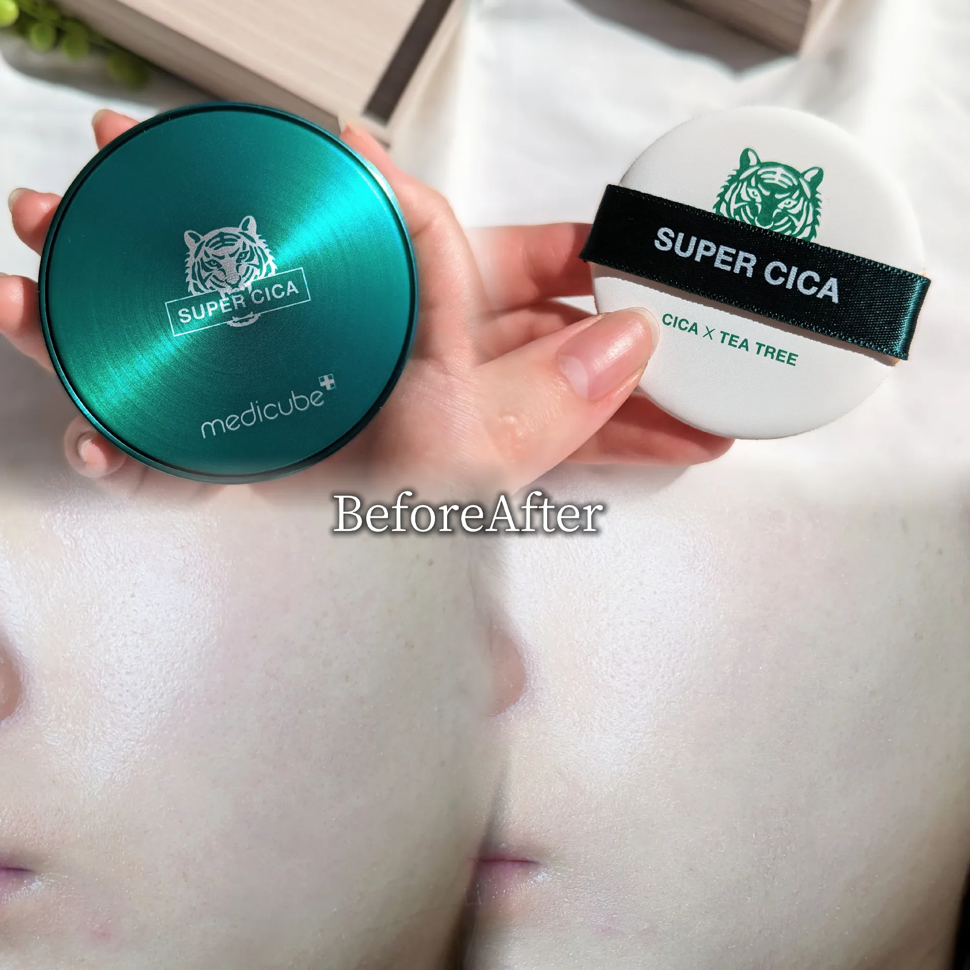 ✓ Deer for rough skin! MEDICUBE! | Gallery posted by nini(にに | Lemon8