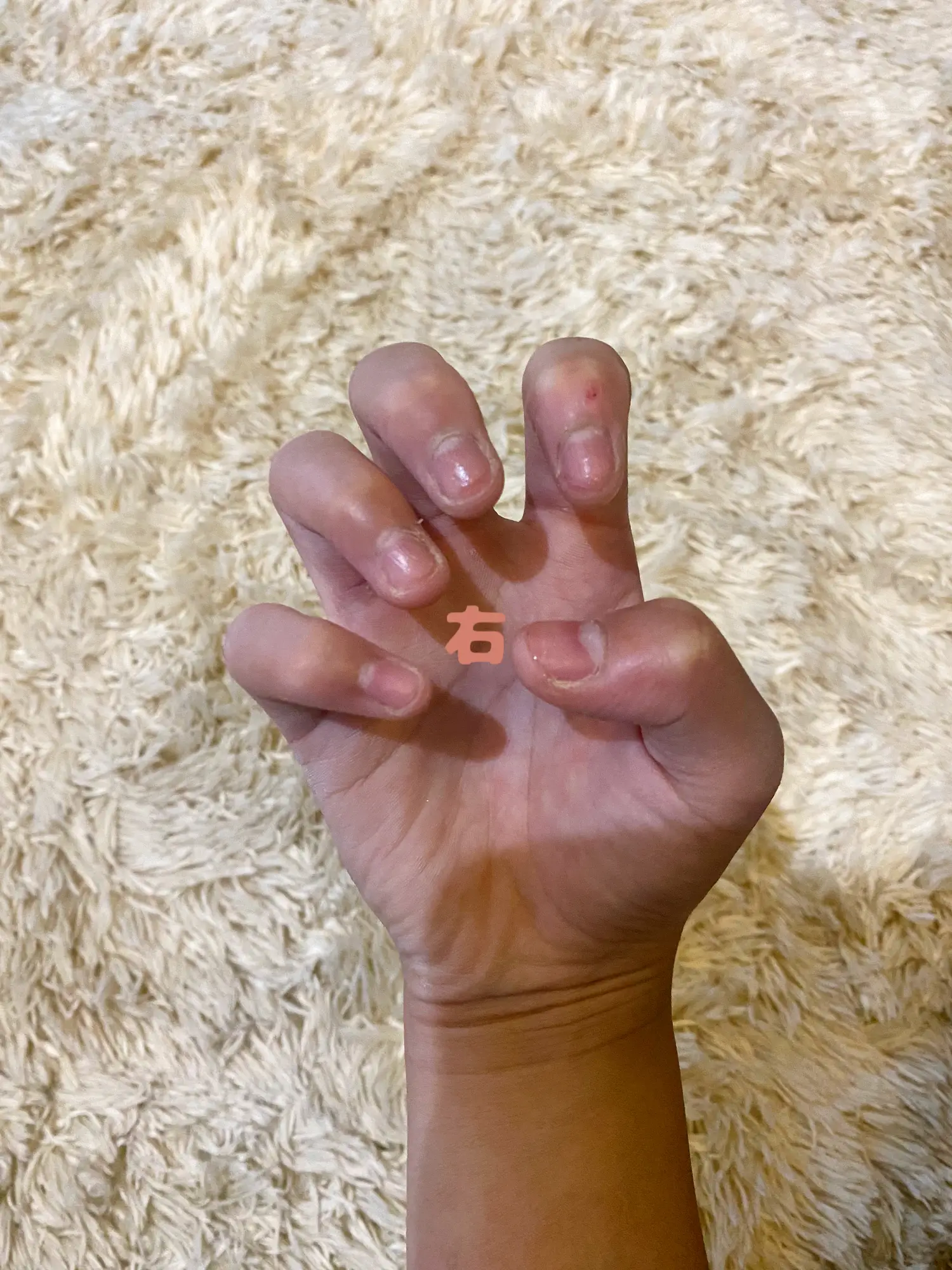 男子小学生 爪噛み ブログ 爪噛みなおします | せいら🩶🫨が投稿したフォトブック | Lemon8