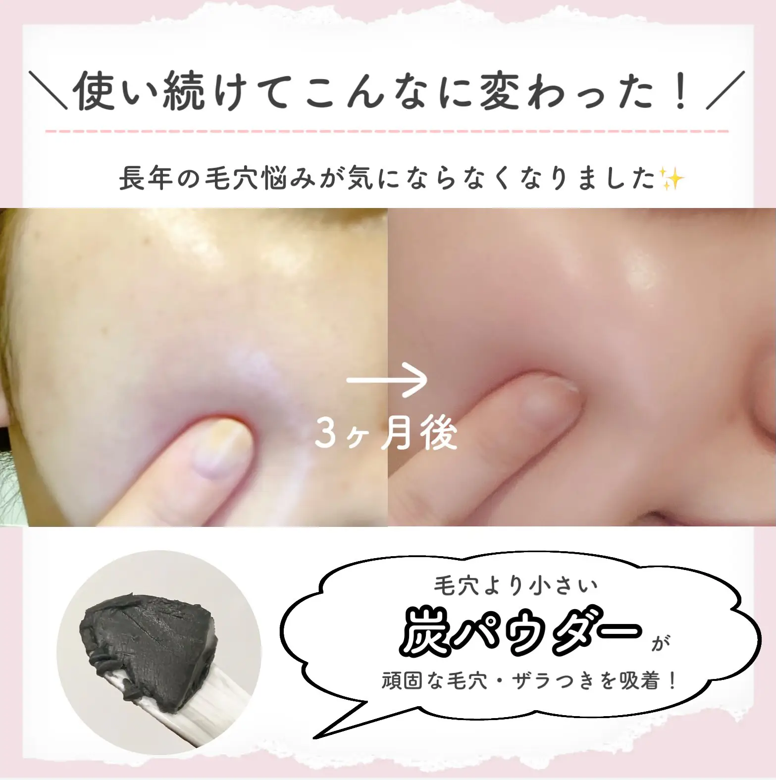 おすすめのクレンジングです💁‍♀️♥️ | cocotte_nailが投稿した