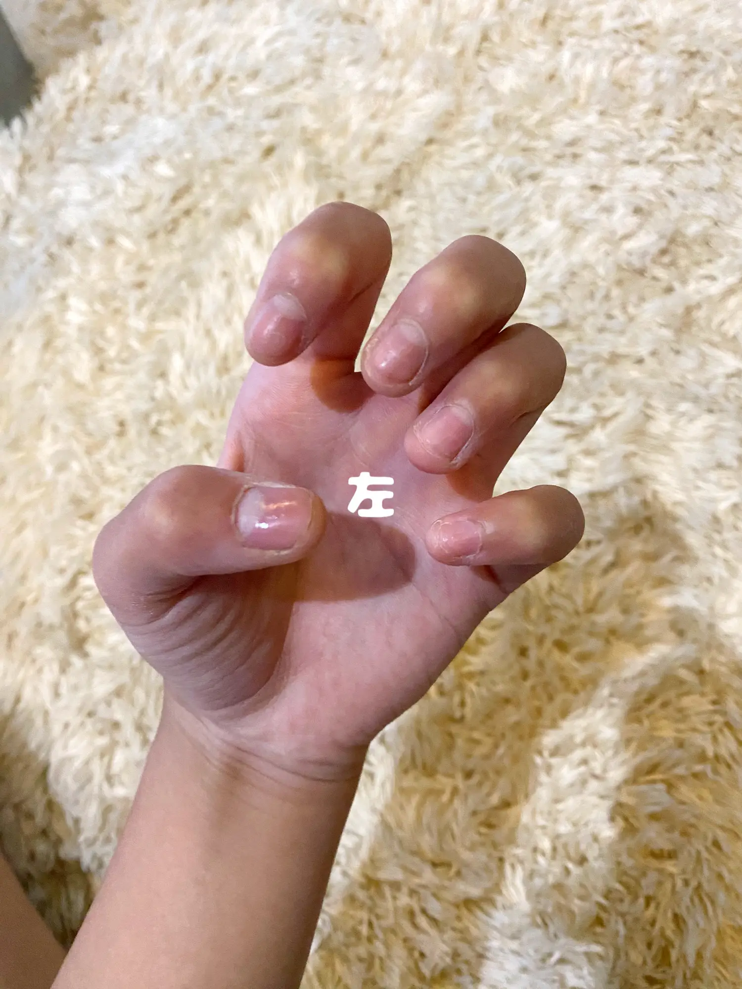 男子小学生 爪噛み ブログ 爪噛みなおします | せいら🩶🫨が投稿したフォトブック | Lemon8