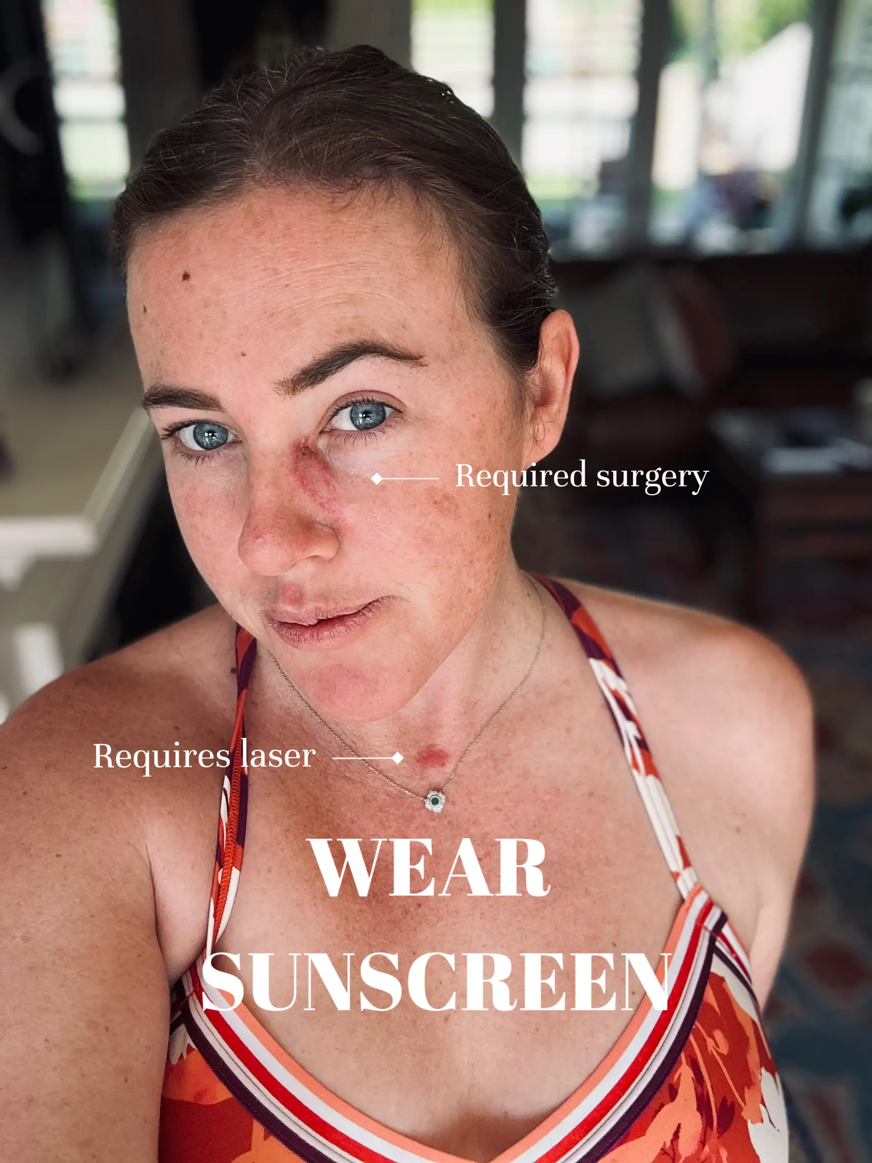 The Big C: Wear Your Sunscreen | KellieBeeが投稿したフォトブック | Lemon8