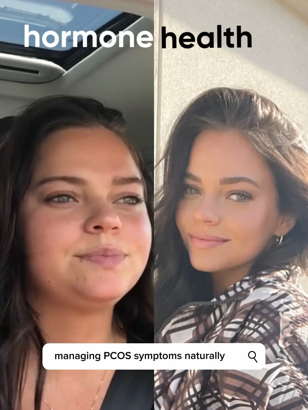 Gracie Norton Before and After - Lemon8 Search