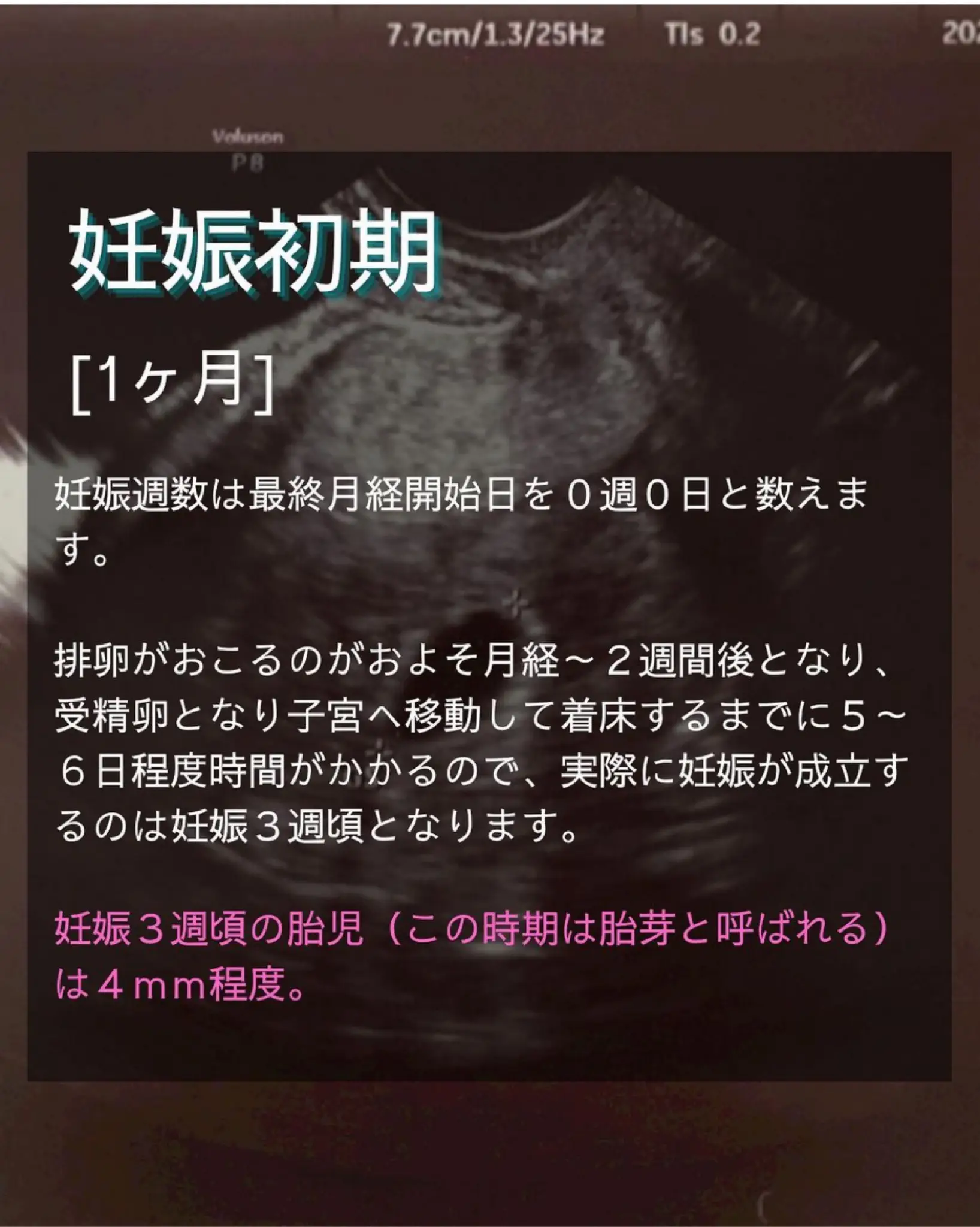 妊娠初期】気になる胎児の成長過程 | ゆーすけ_新米パパが投稿した