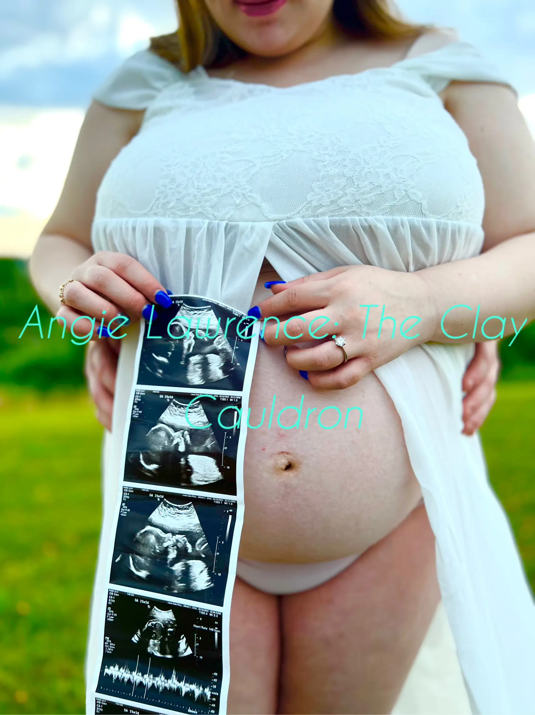 Maternity pictures! | Gallery posted by Angie | Lemon8