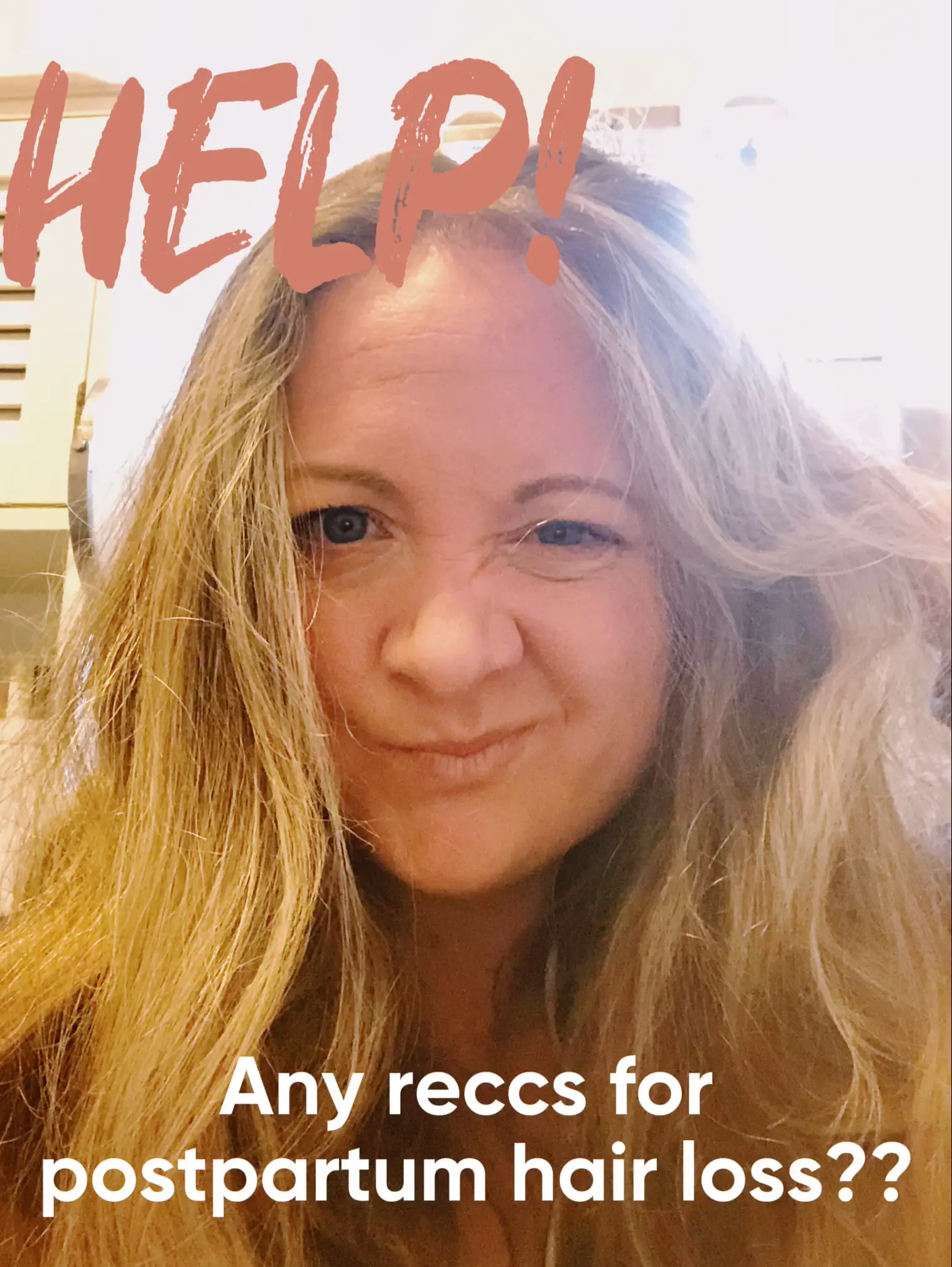 HELP! Tips for post partum hair loss? Gallery posted by Meg 🦋 Lemon8