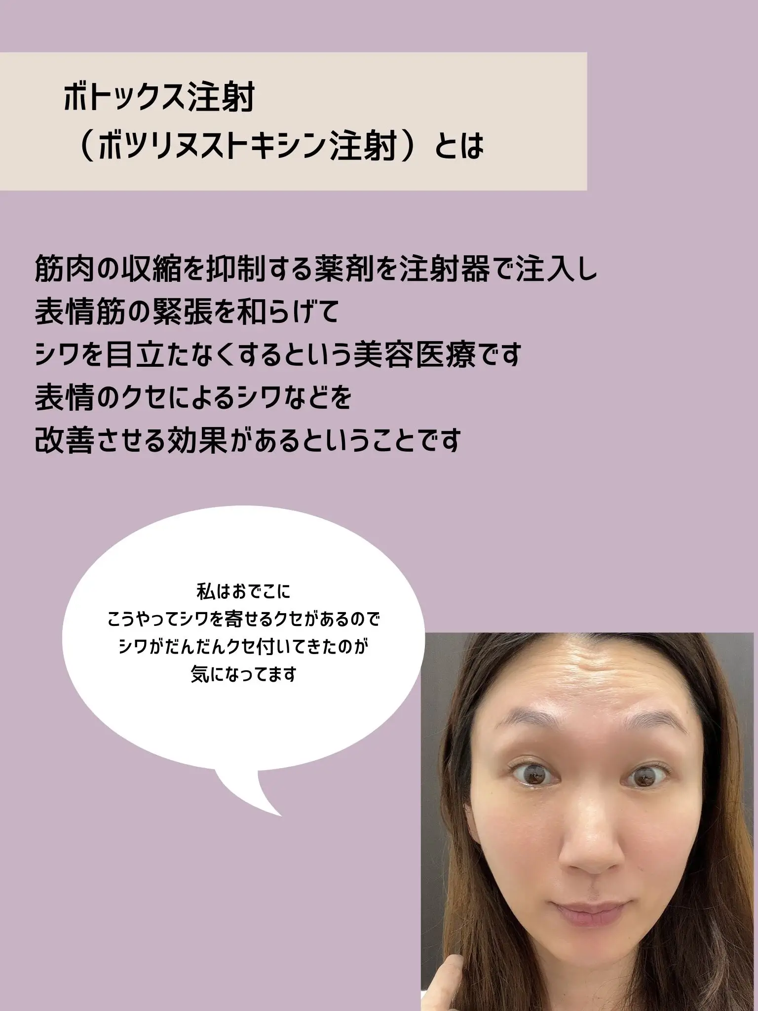 新橋武ボツリヌストキシンによる美容治療 実践講座 (PEPARS(ペパーズ