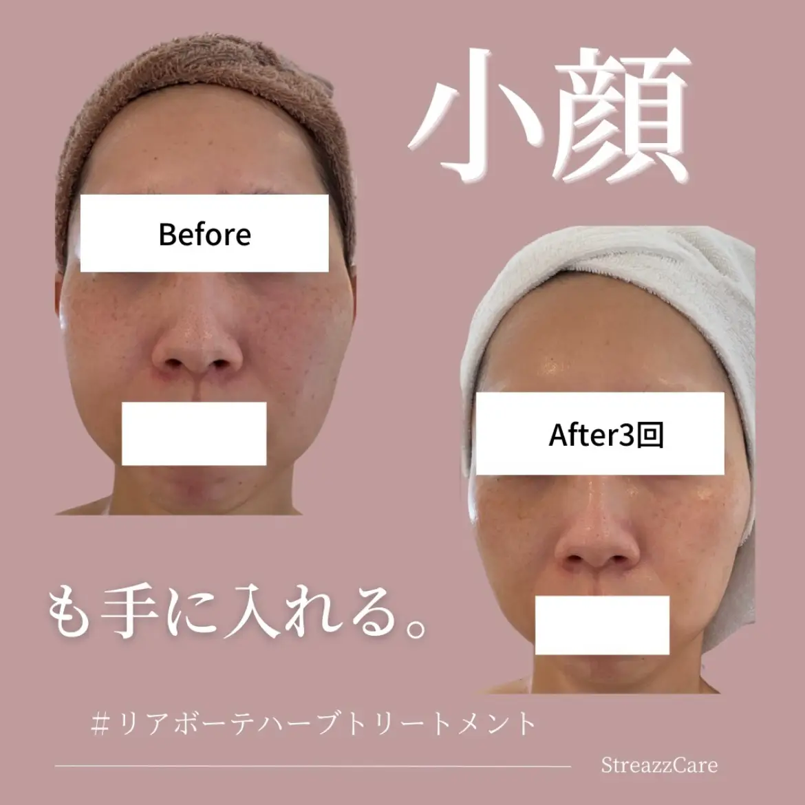 剥離無しハーブピーリング 30回分→30g 剥がれ