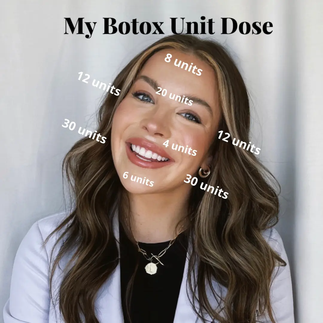 How Many Units Of Botox Do I Get? | Gallery Posted By Charlotte Bader ...